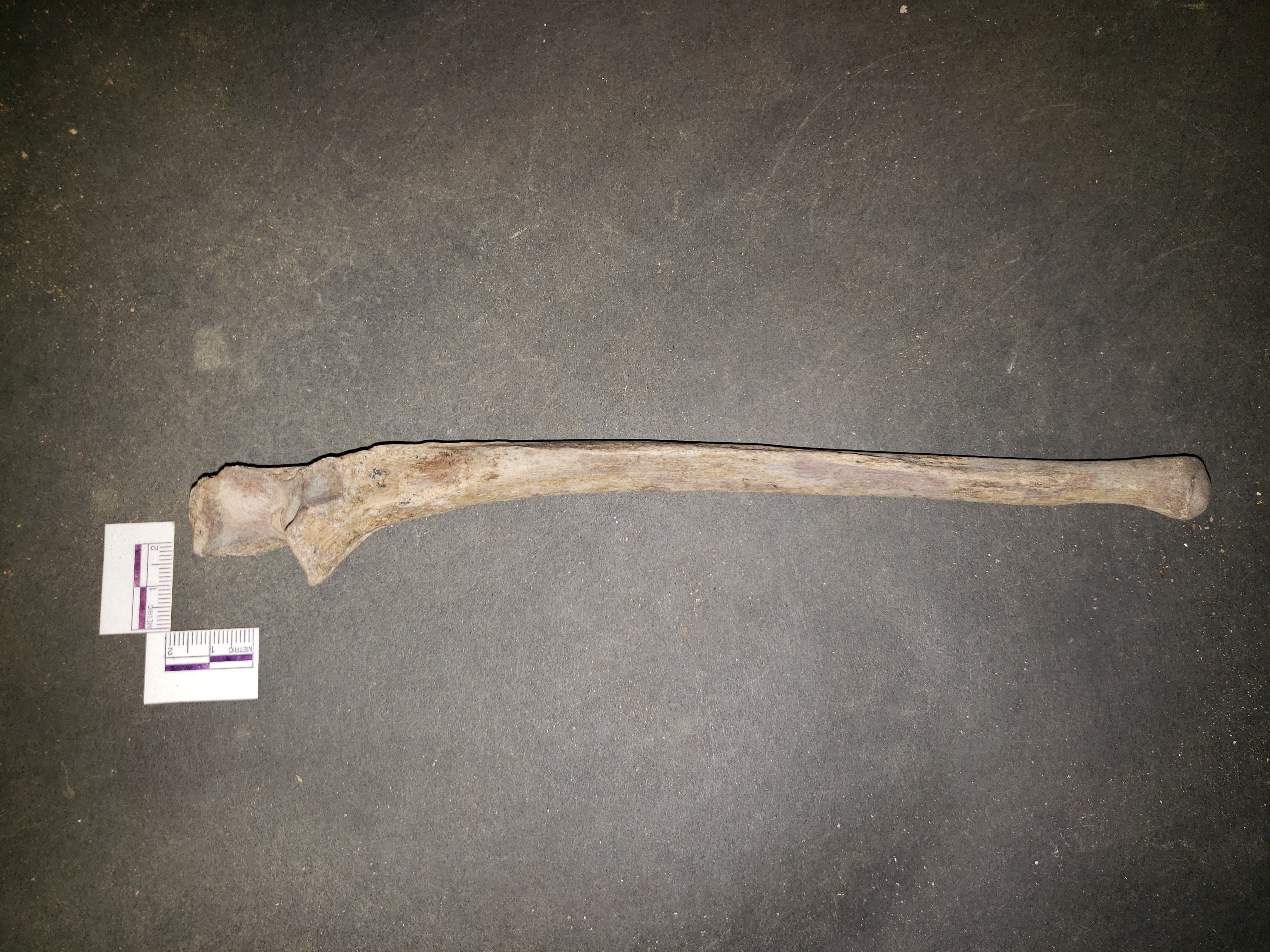 Anterior view