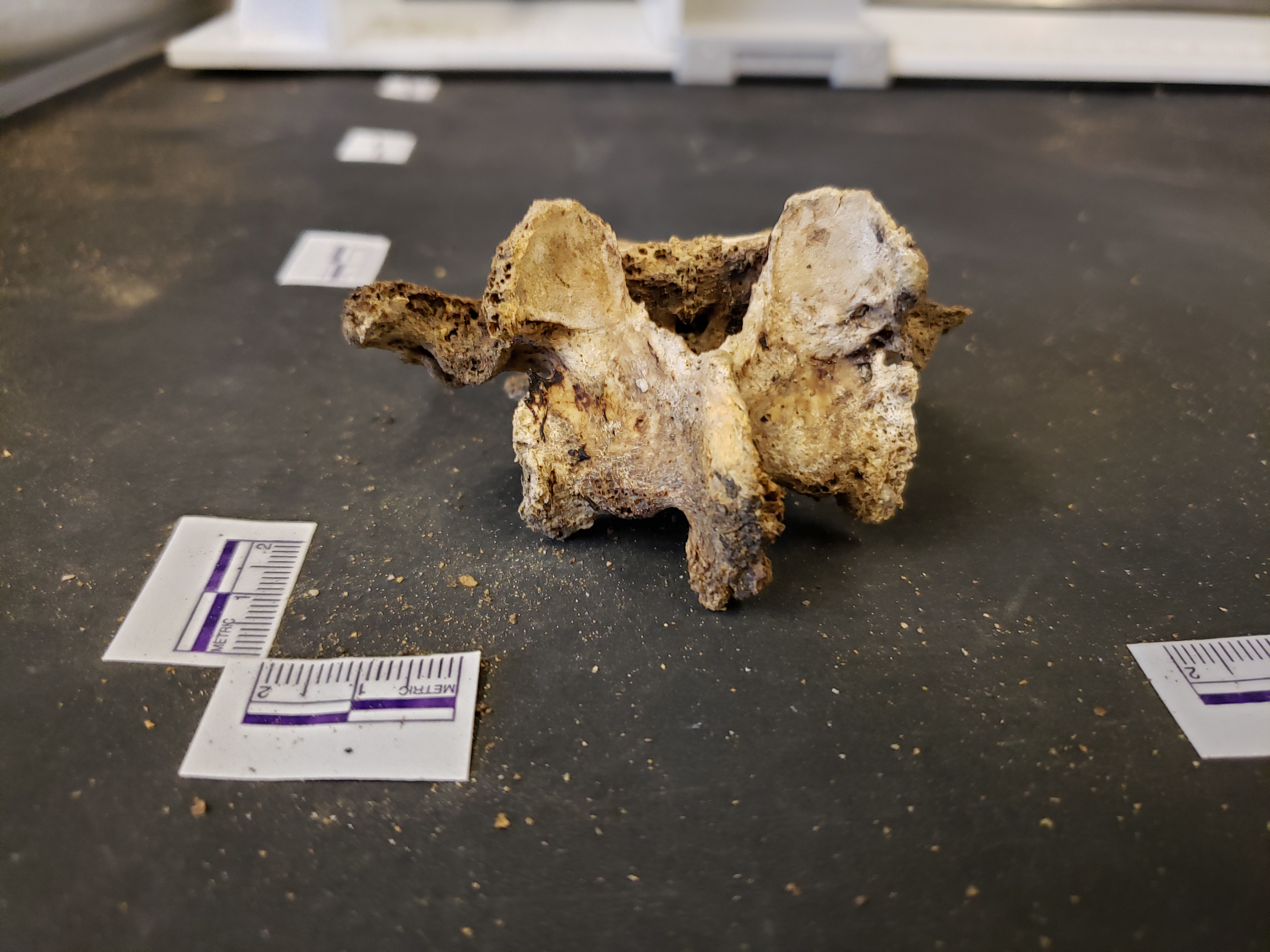 Posterior view