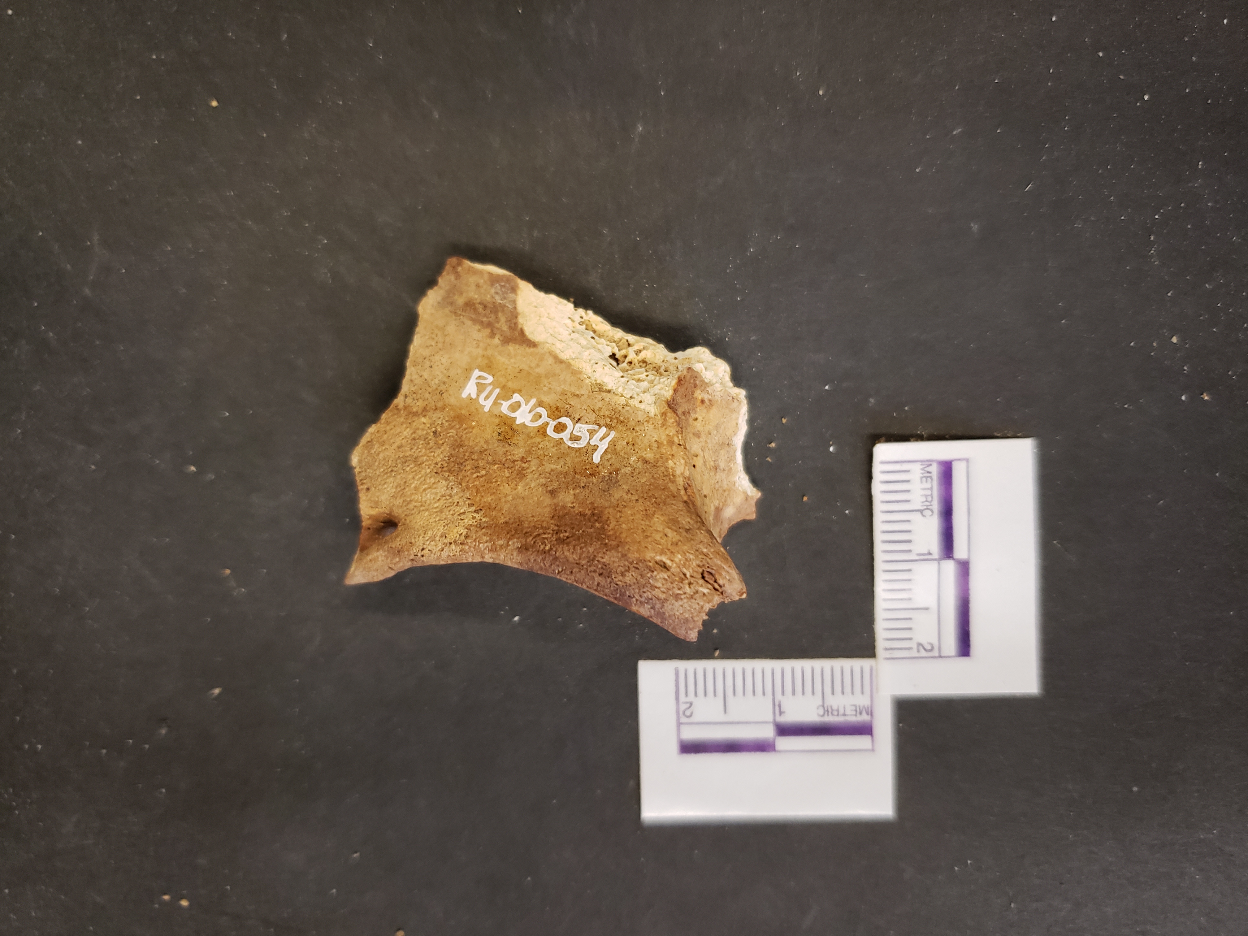 Anterior view (inferior left)
