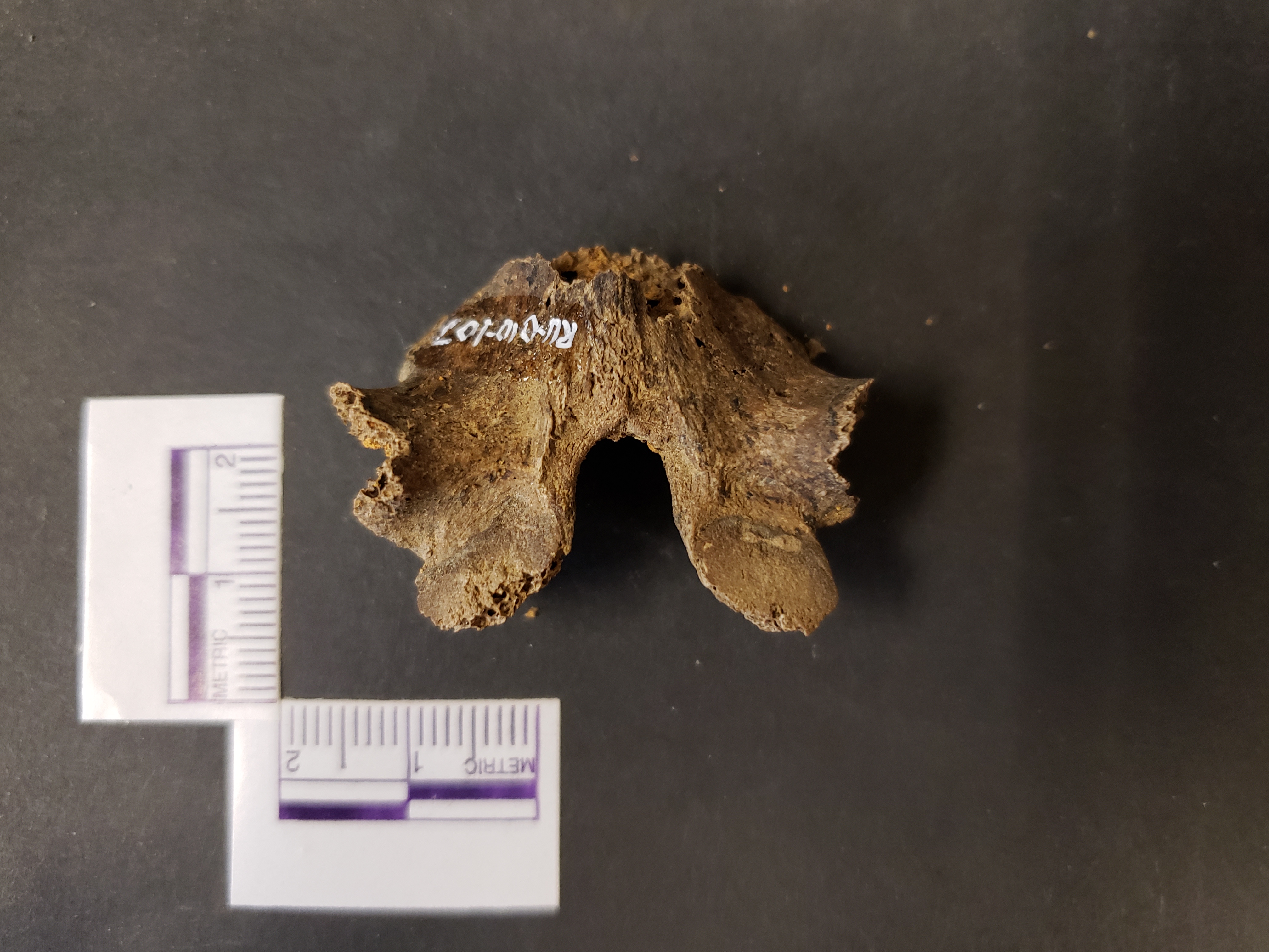 Posterior view (superior left)