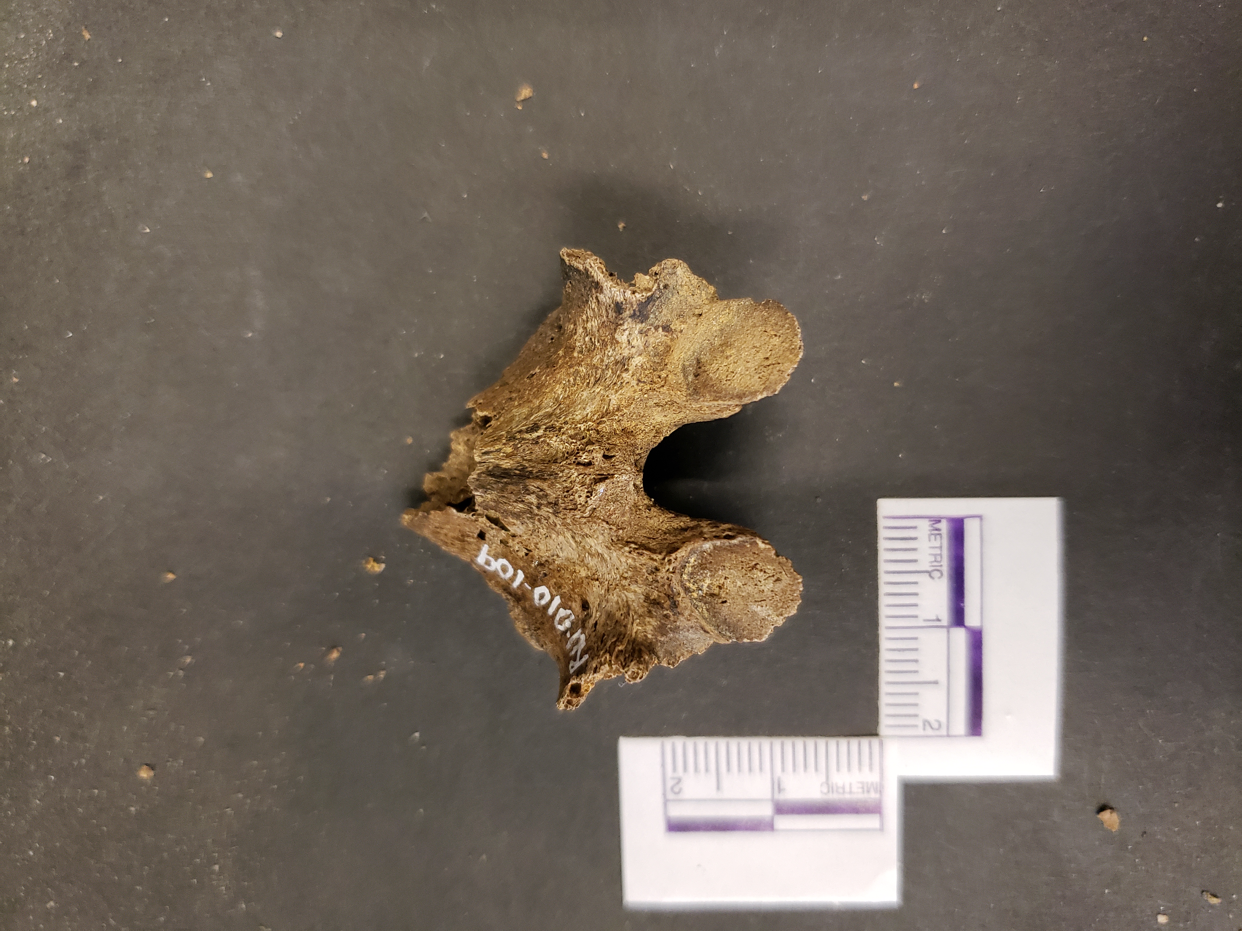 Posterior view (superior down)