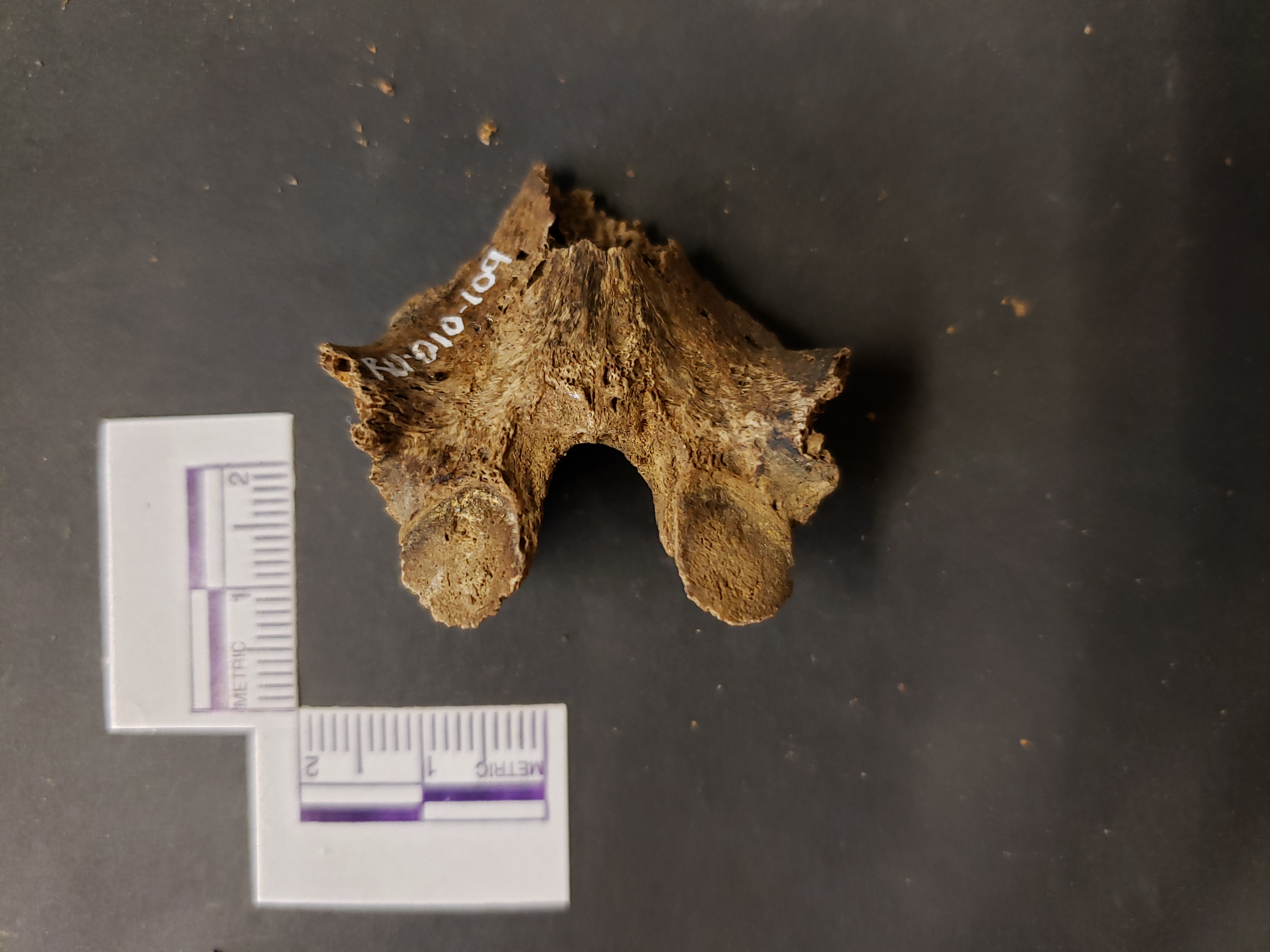 Posterior view (superior left)