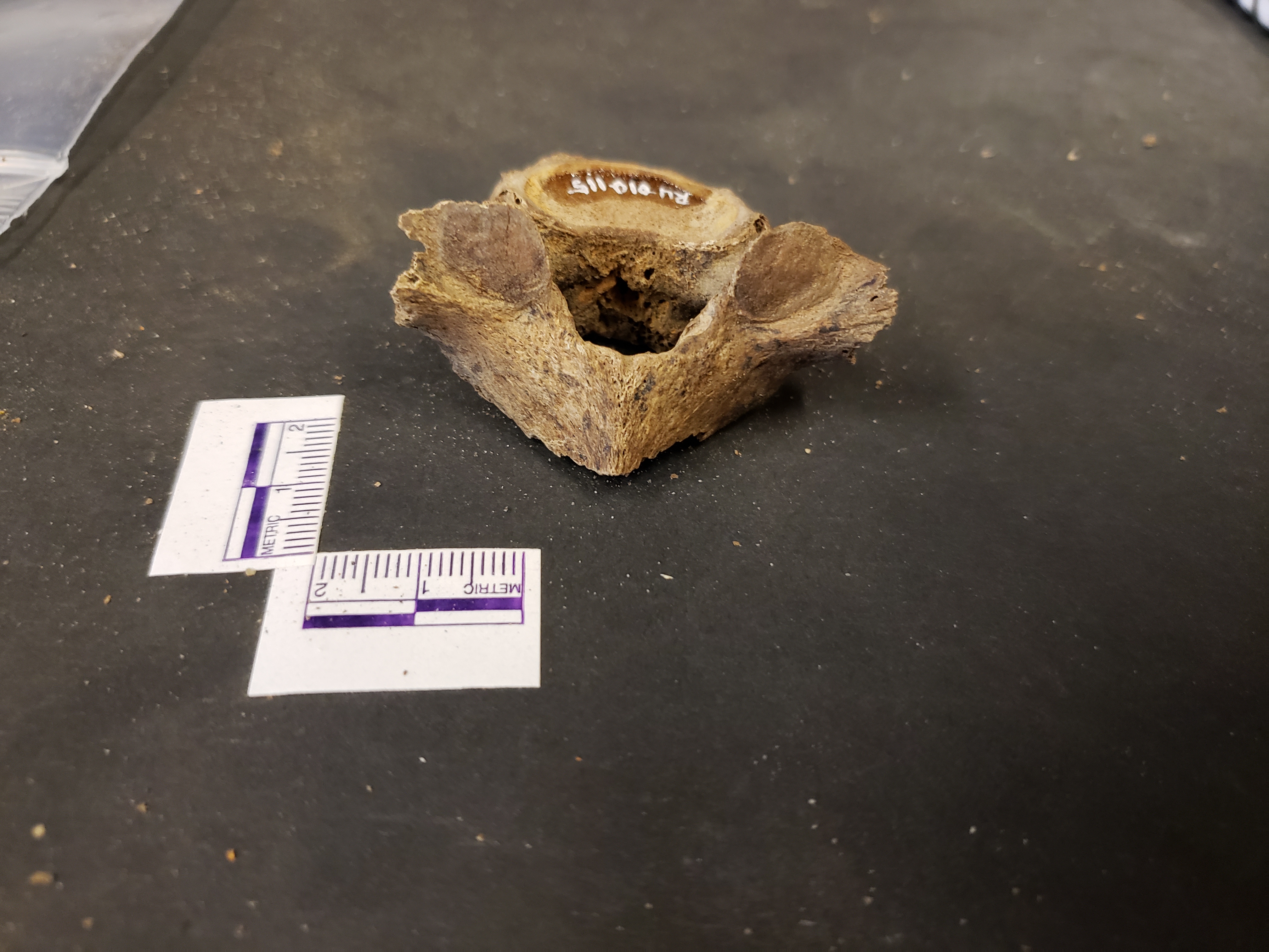 Posterior view