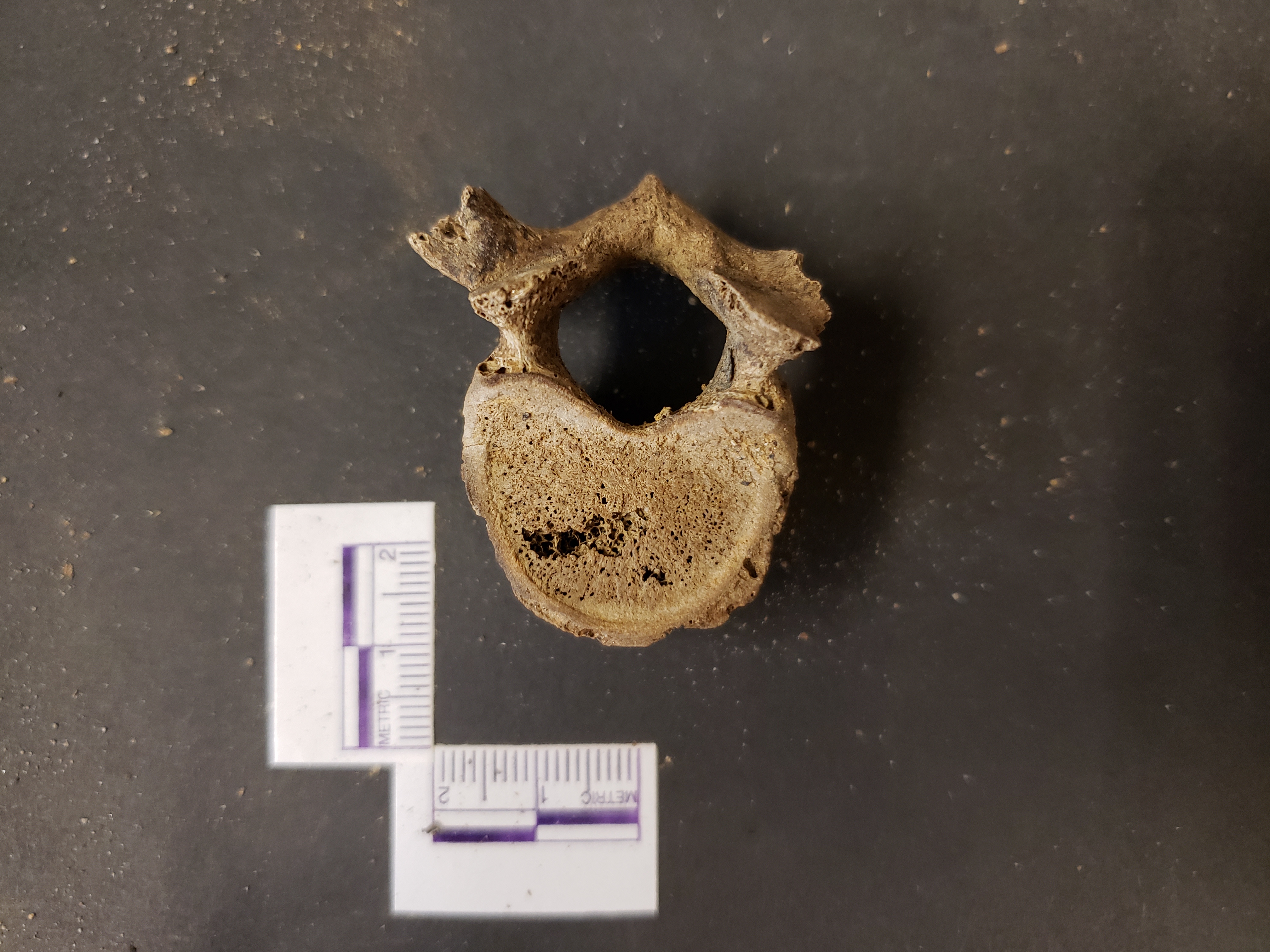 Superior view (anterior left)