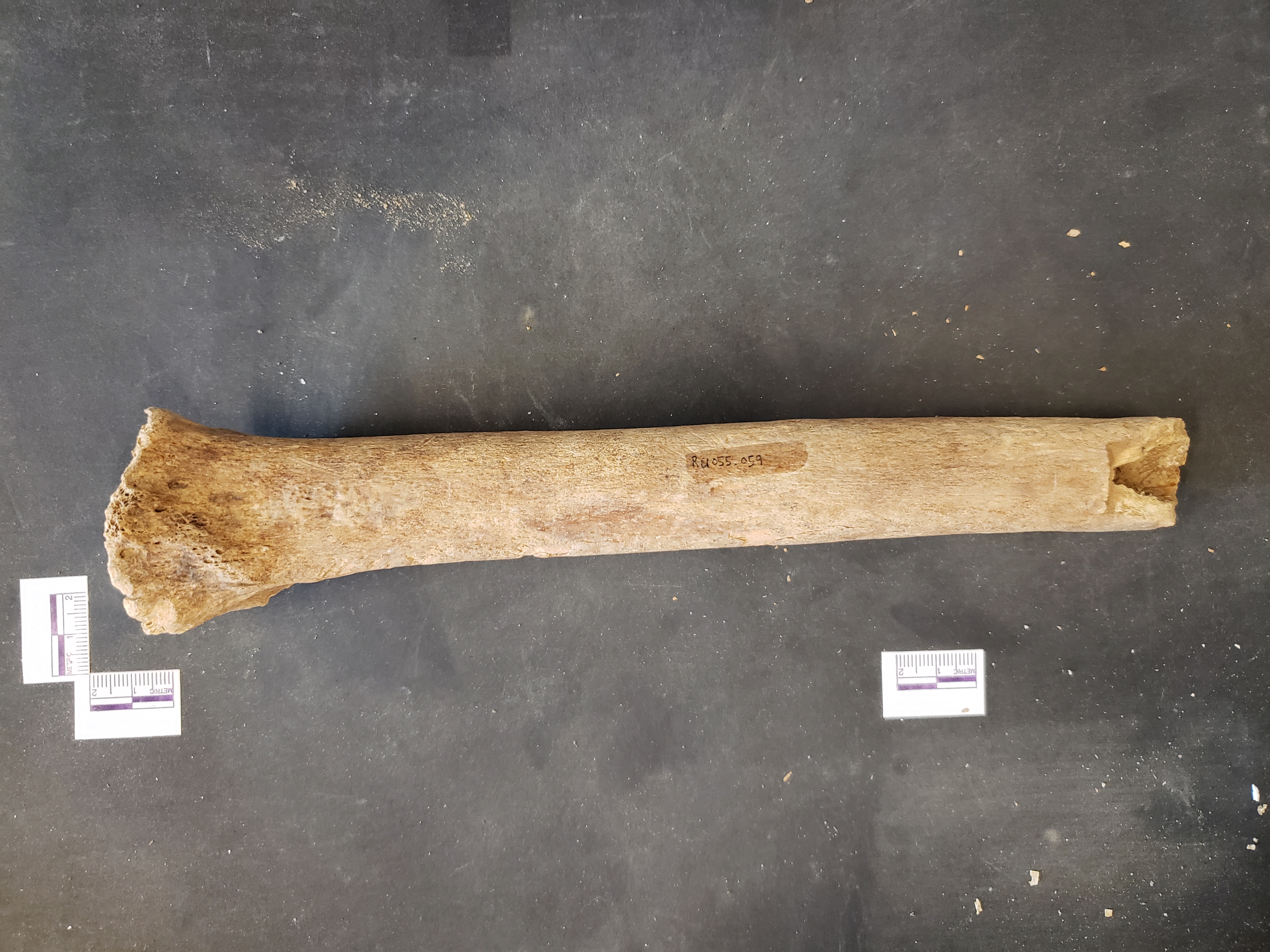 Anterior view