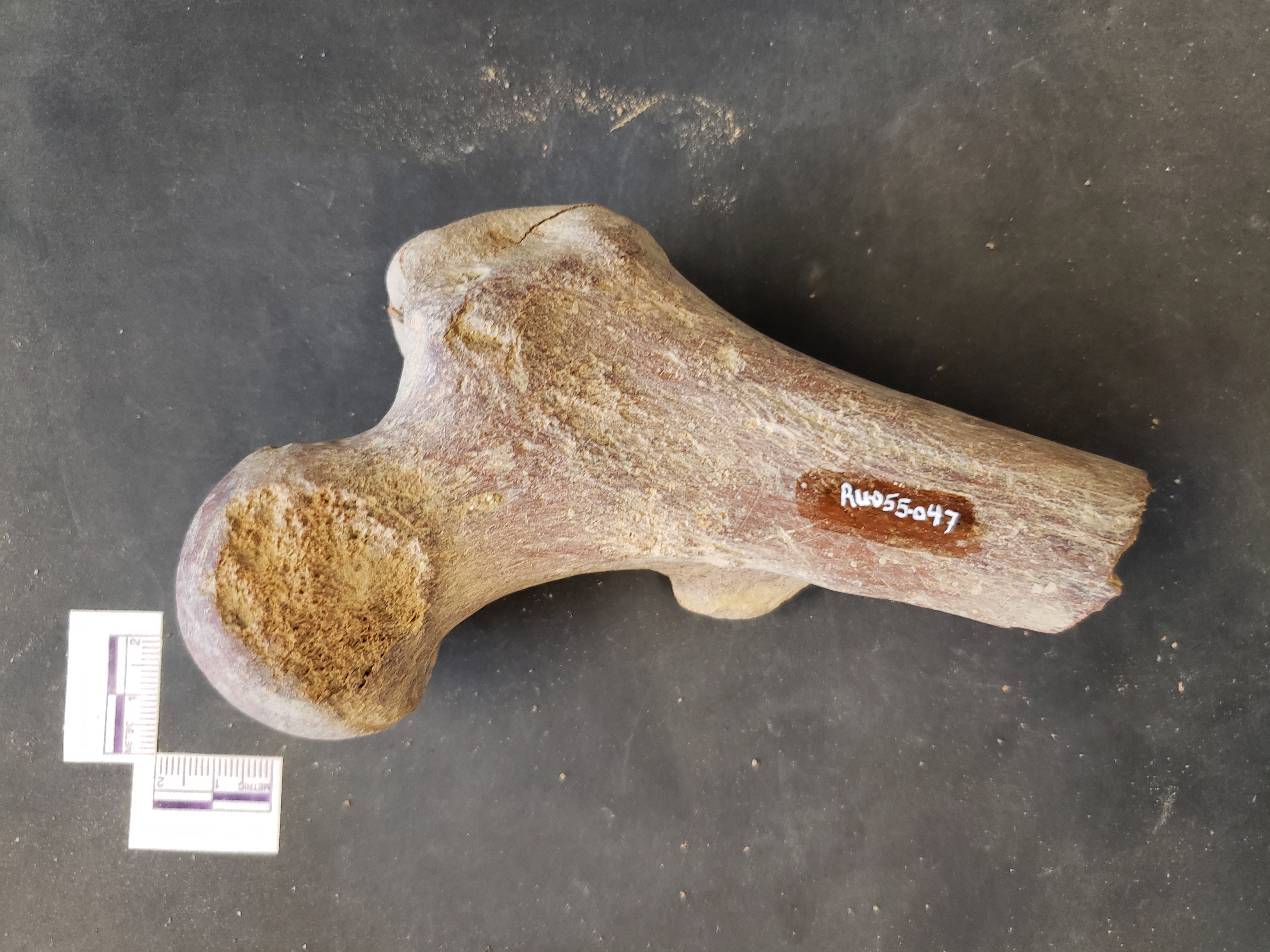 Anterior view