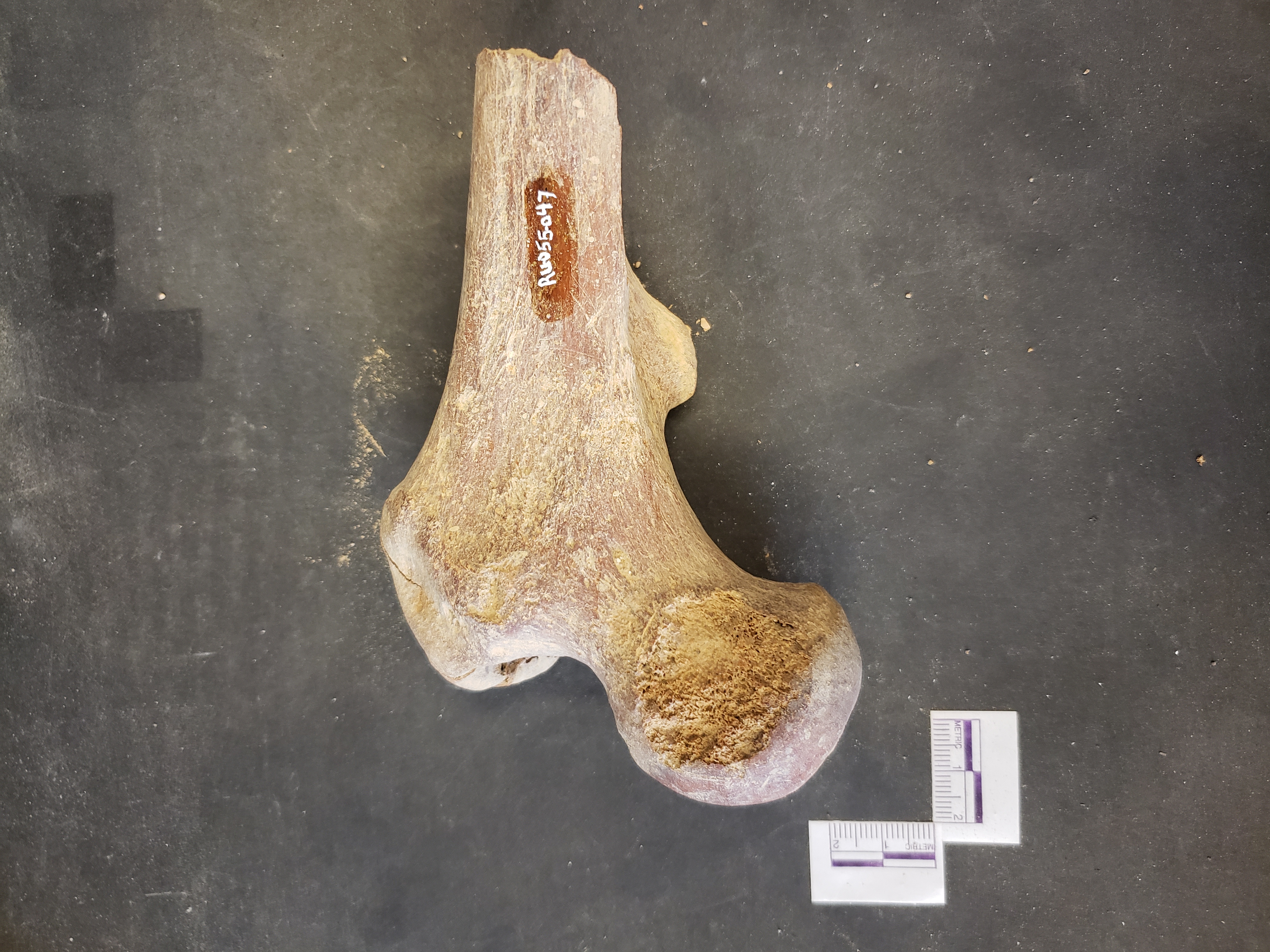 Anterior view