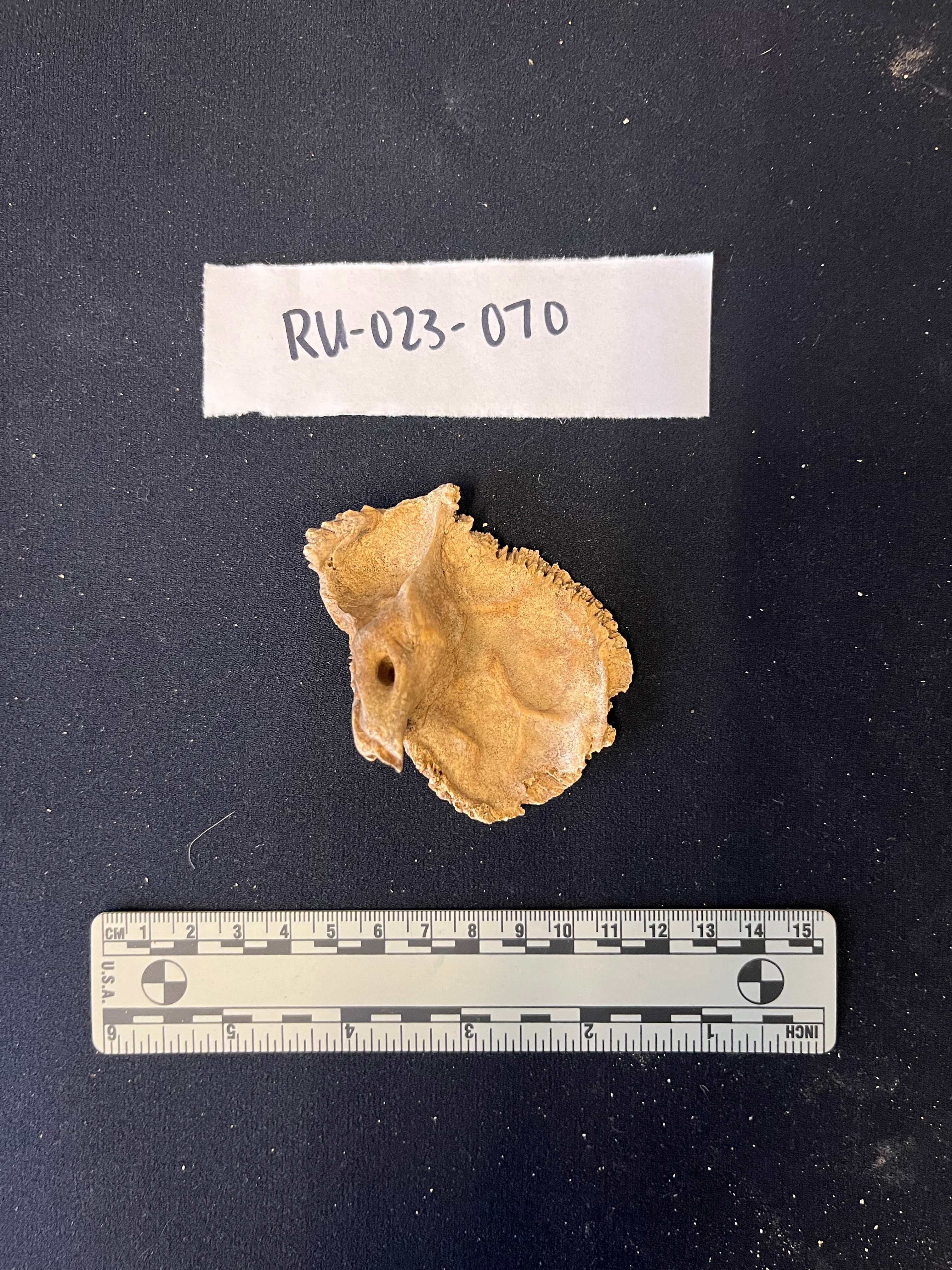 medial view of the left temporal bone
