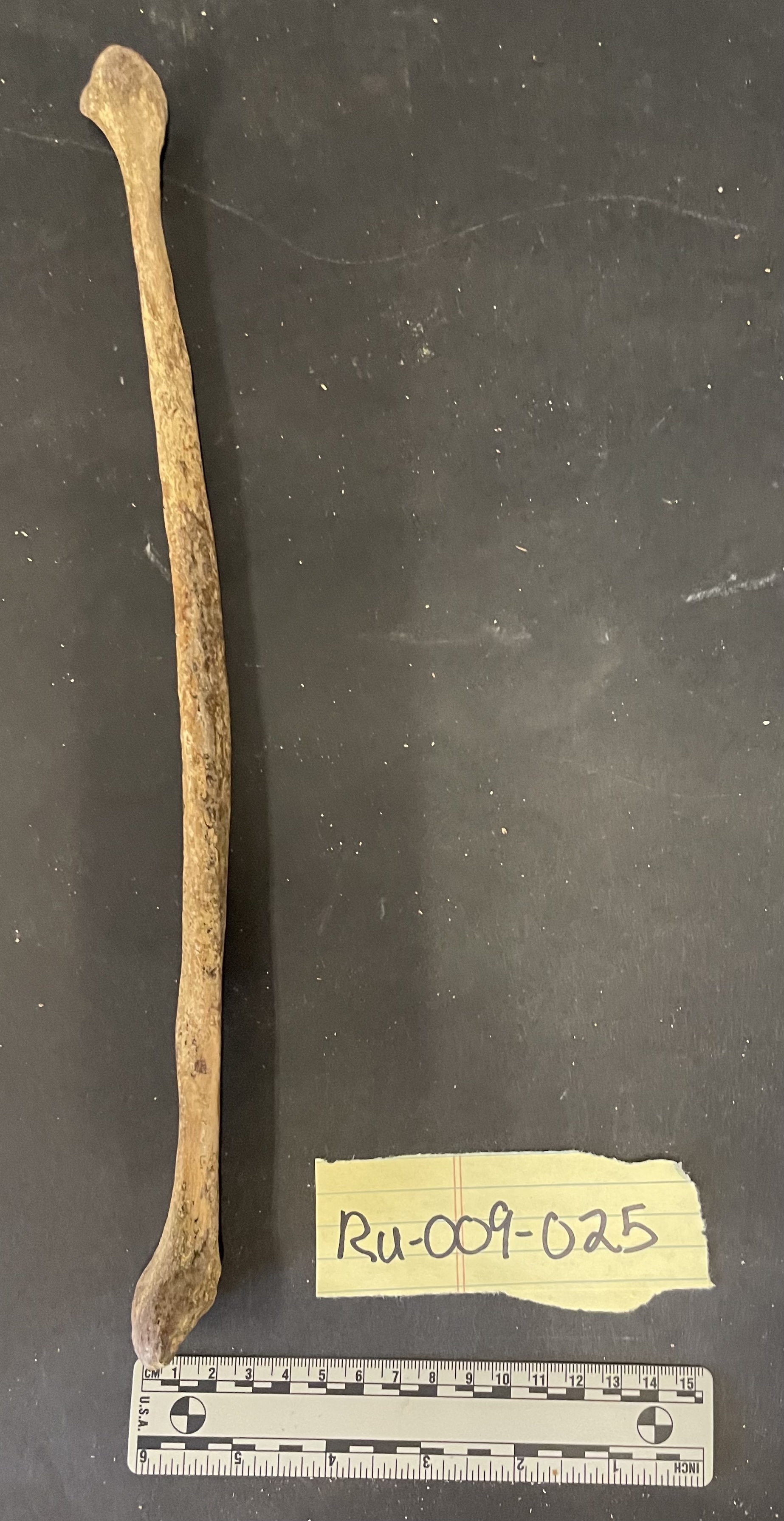 Fibula