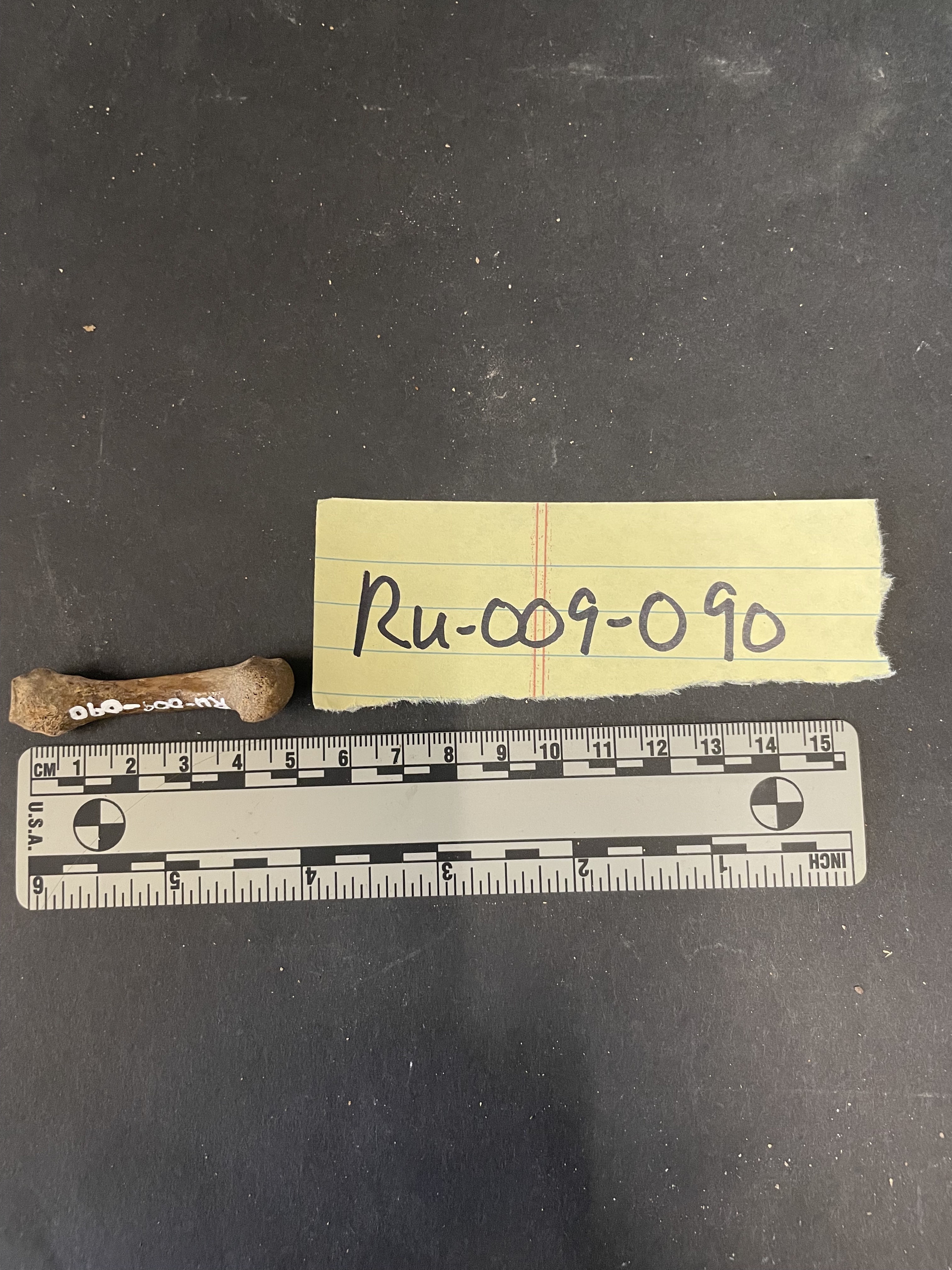 Metacarpal