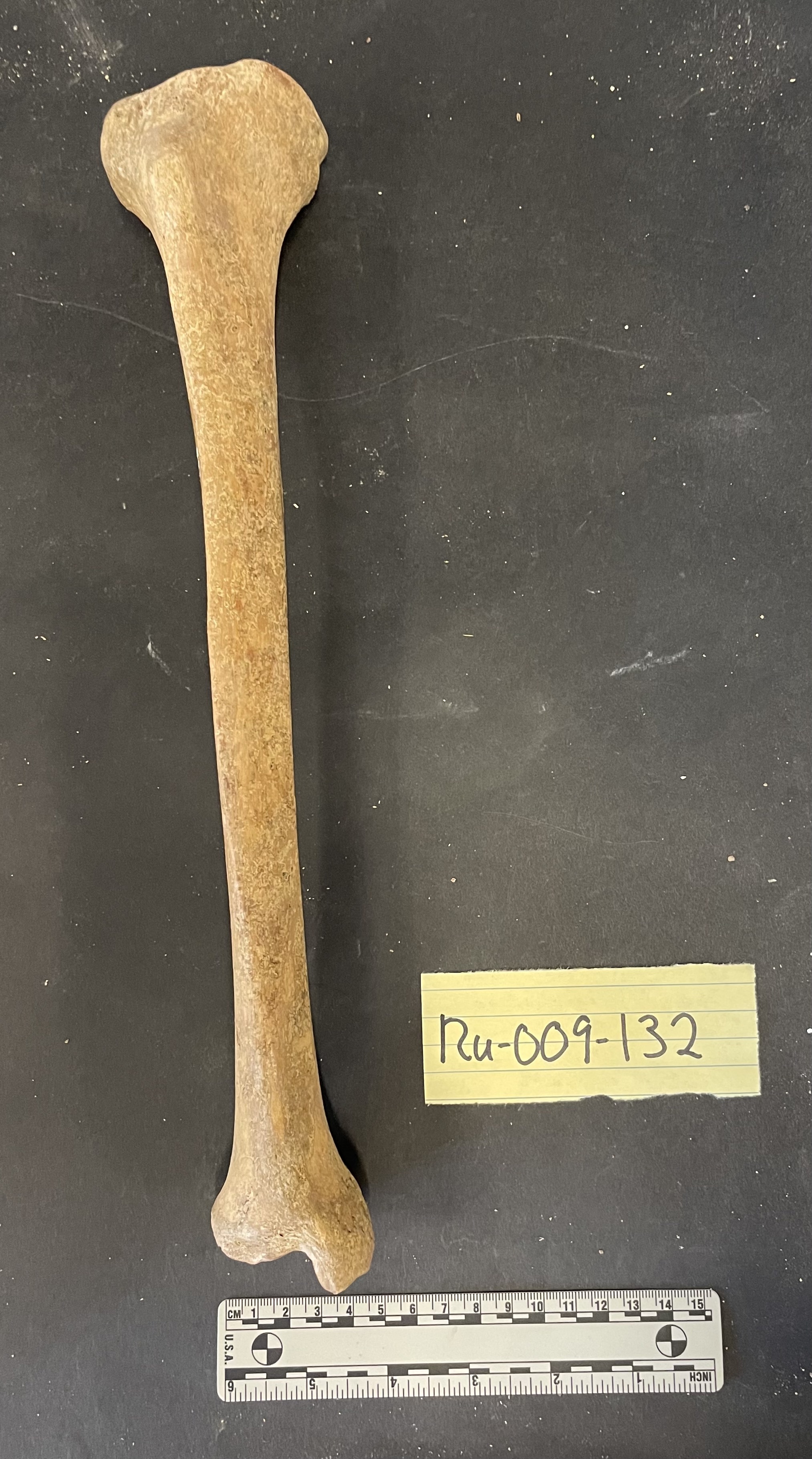 Tibia