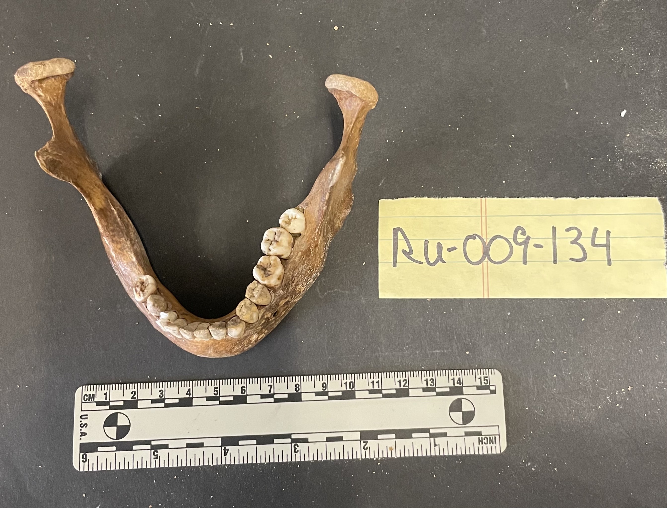Mandible