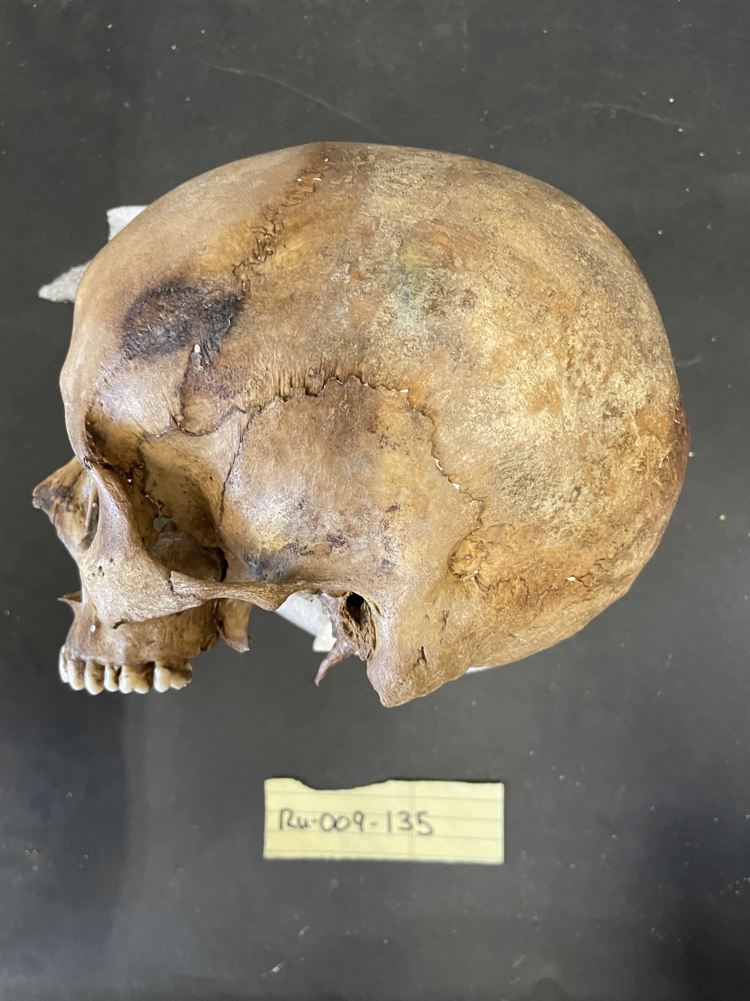 Cranium left lateral view