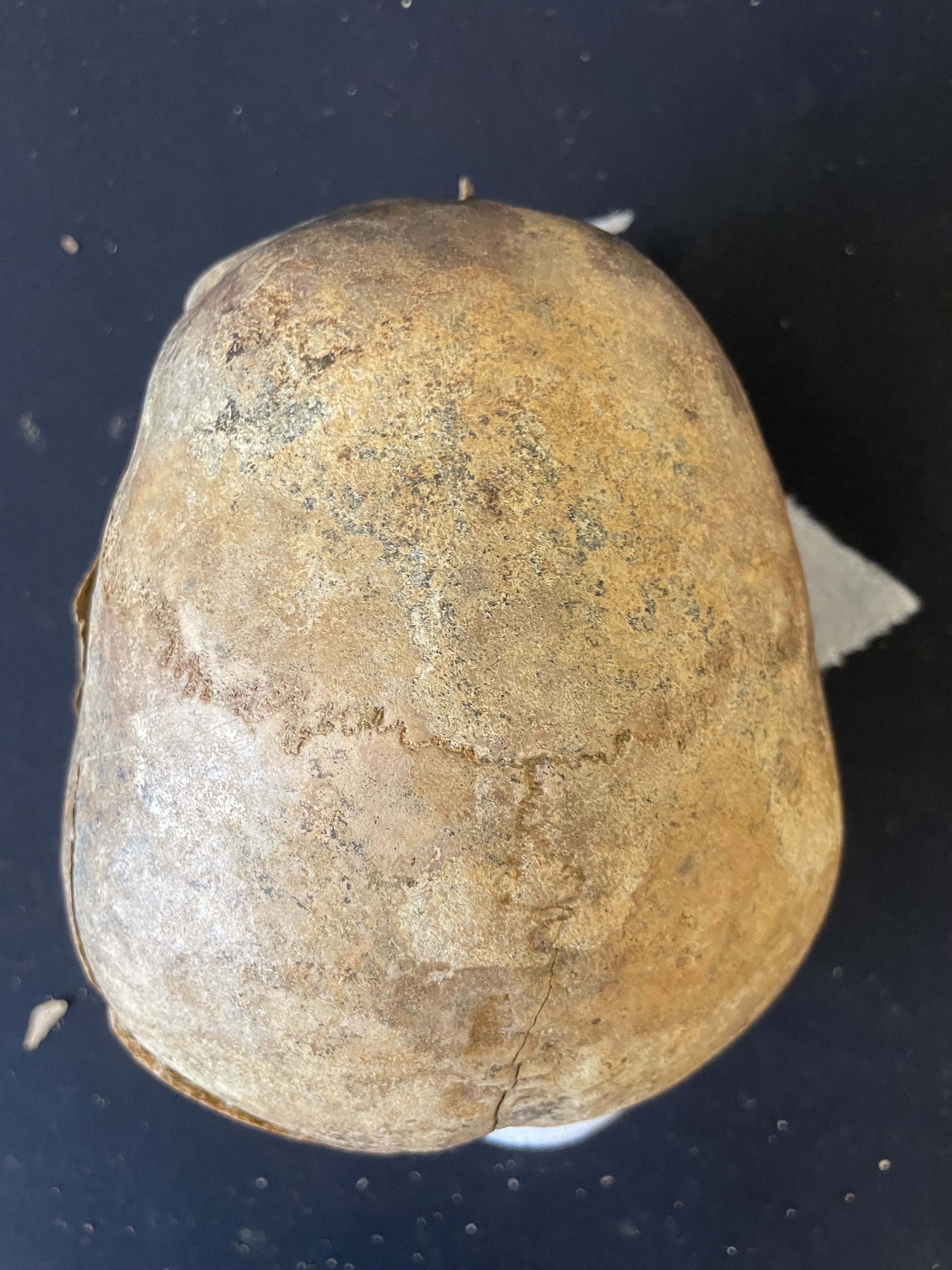 Anterior view of cranium