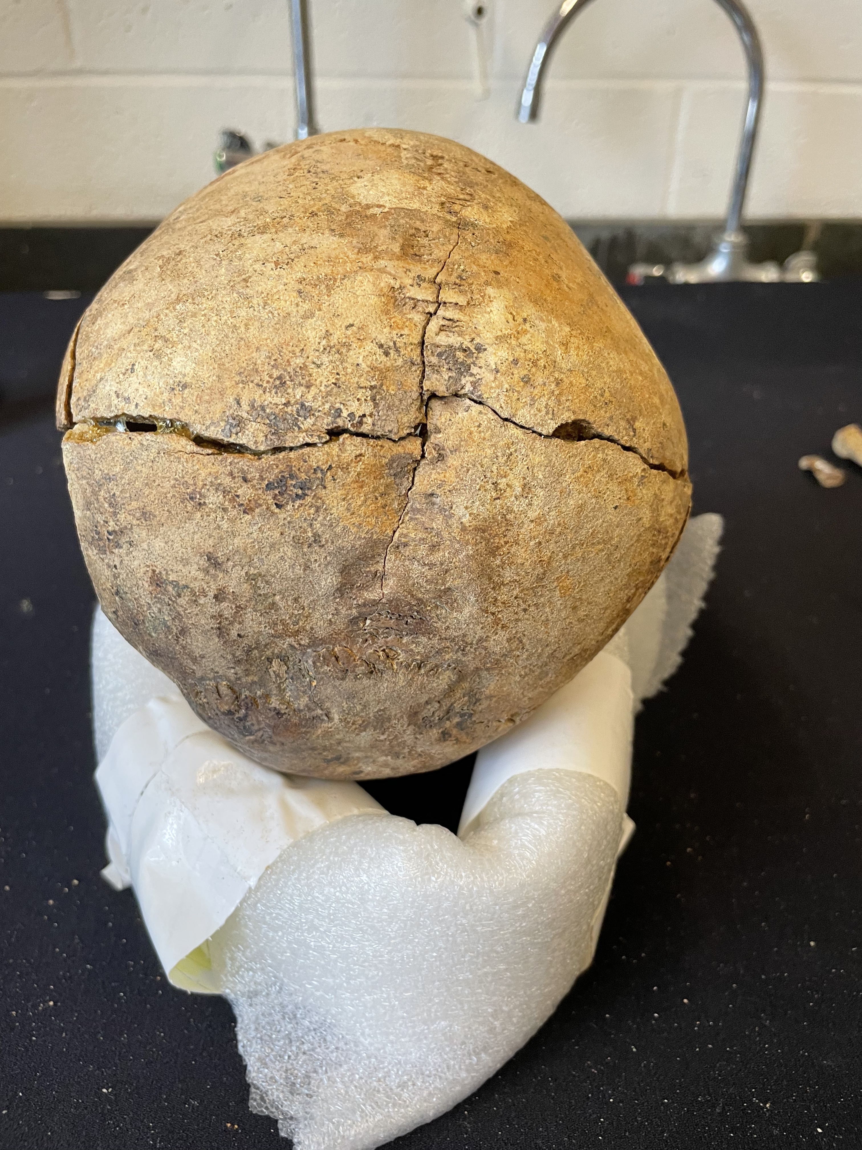 Posterior view of cranium