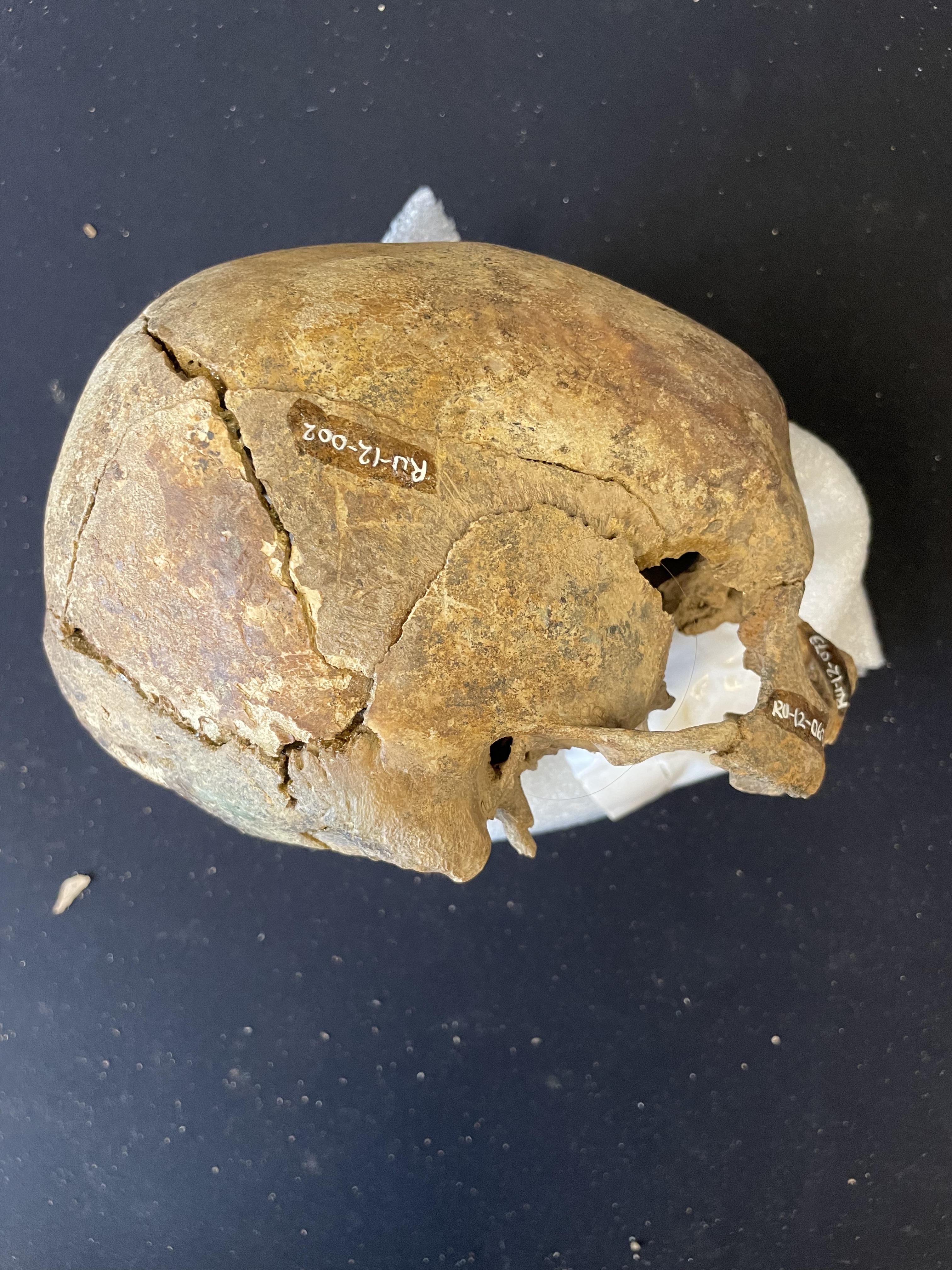 Left lateral view of cranium