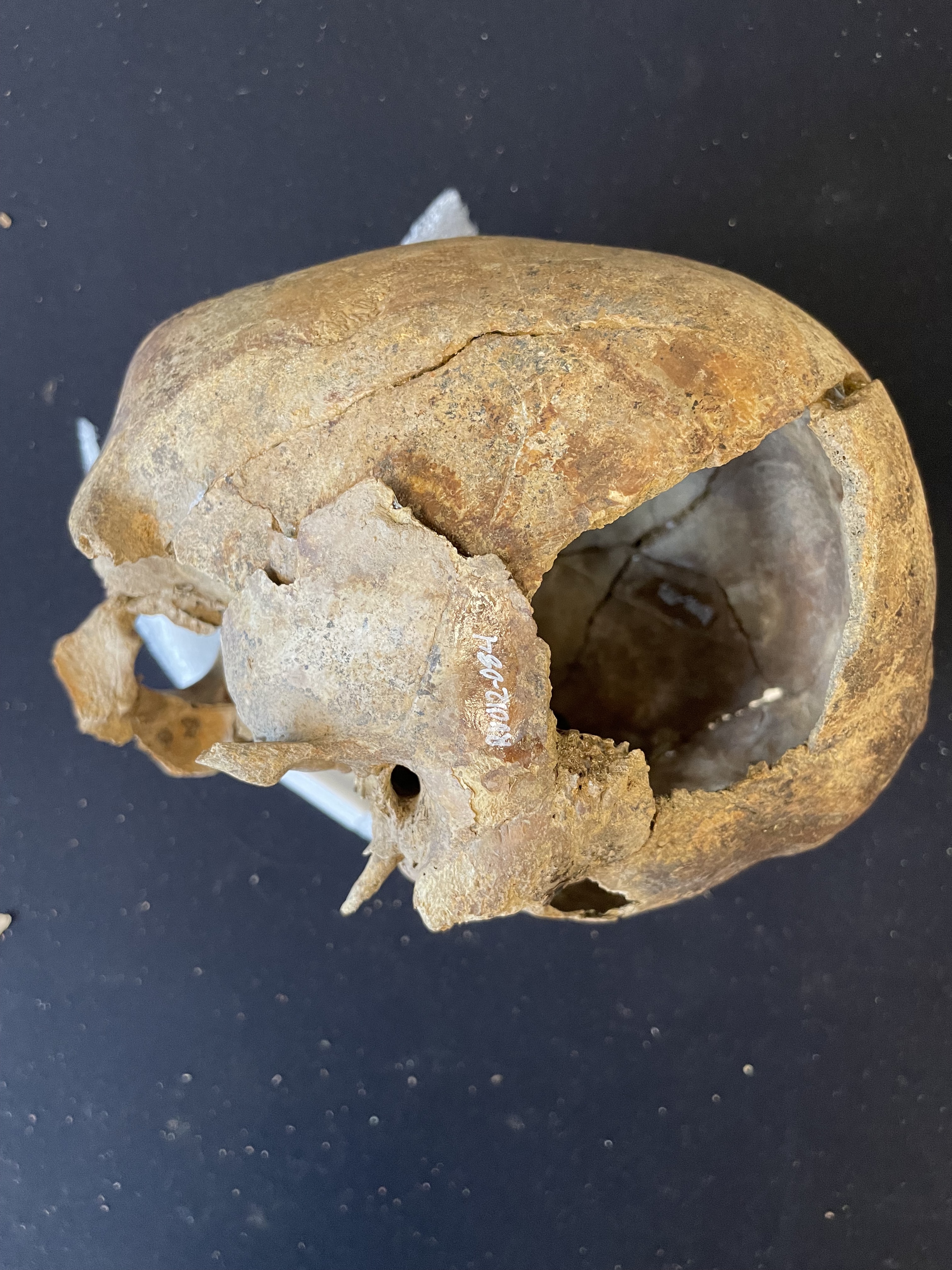 Right lateral view of cranium