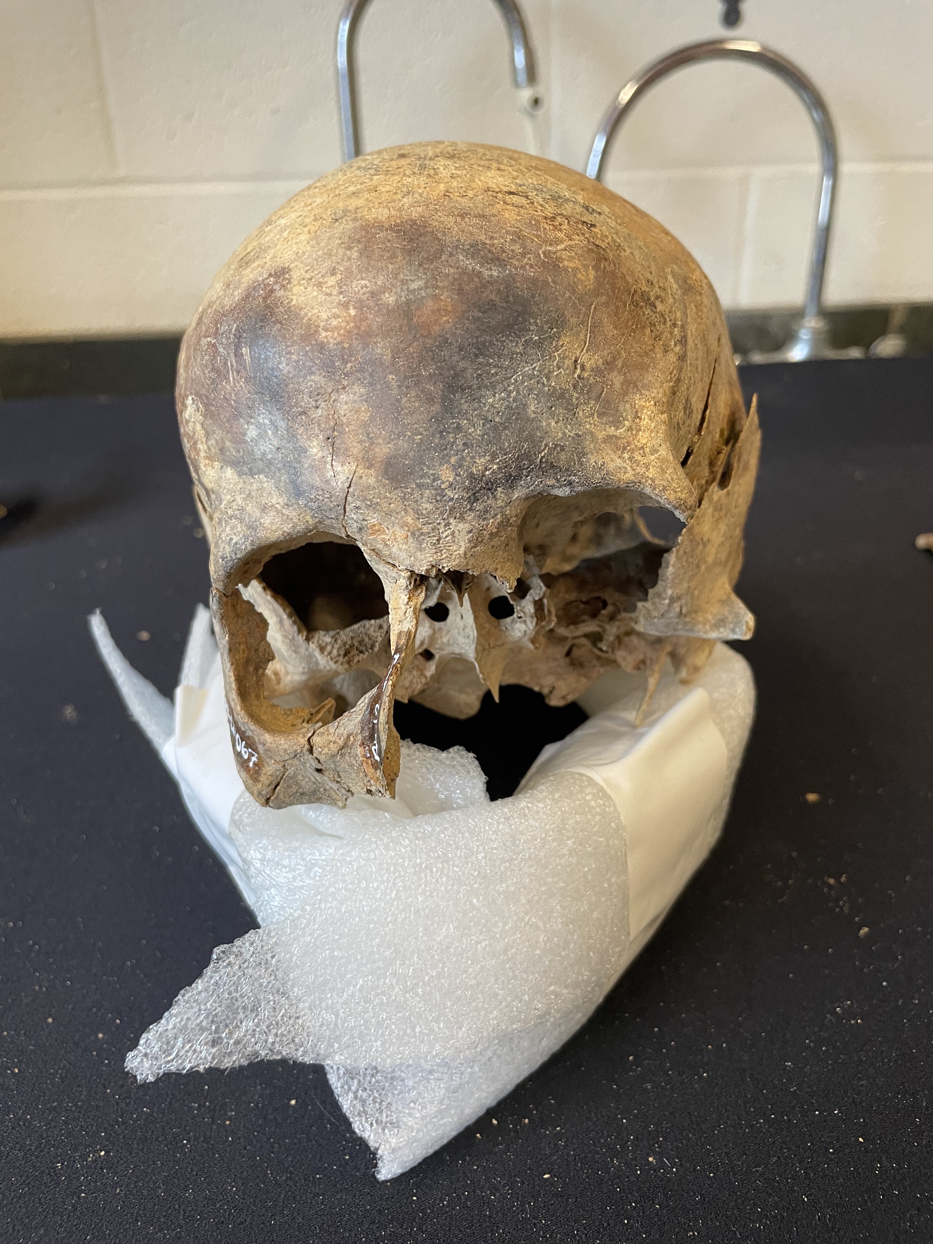 View of cranium showing facial area 