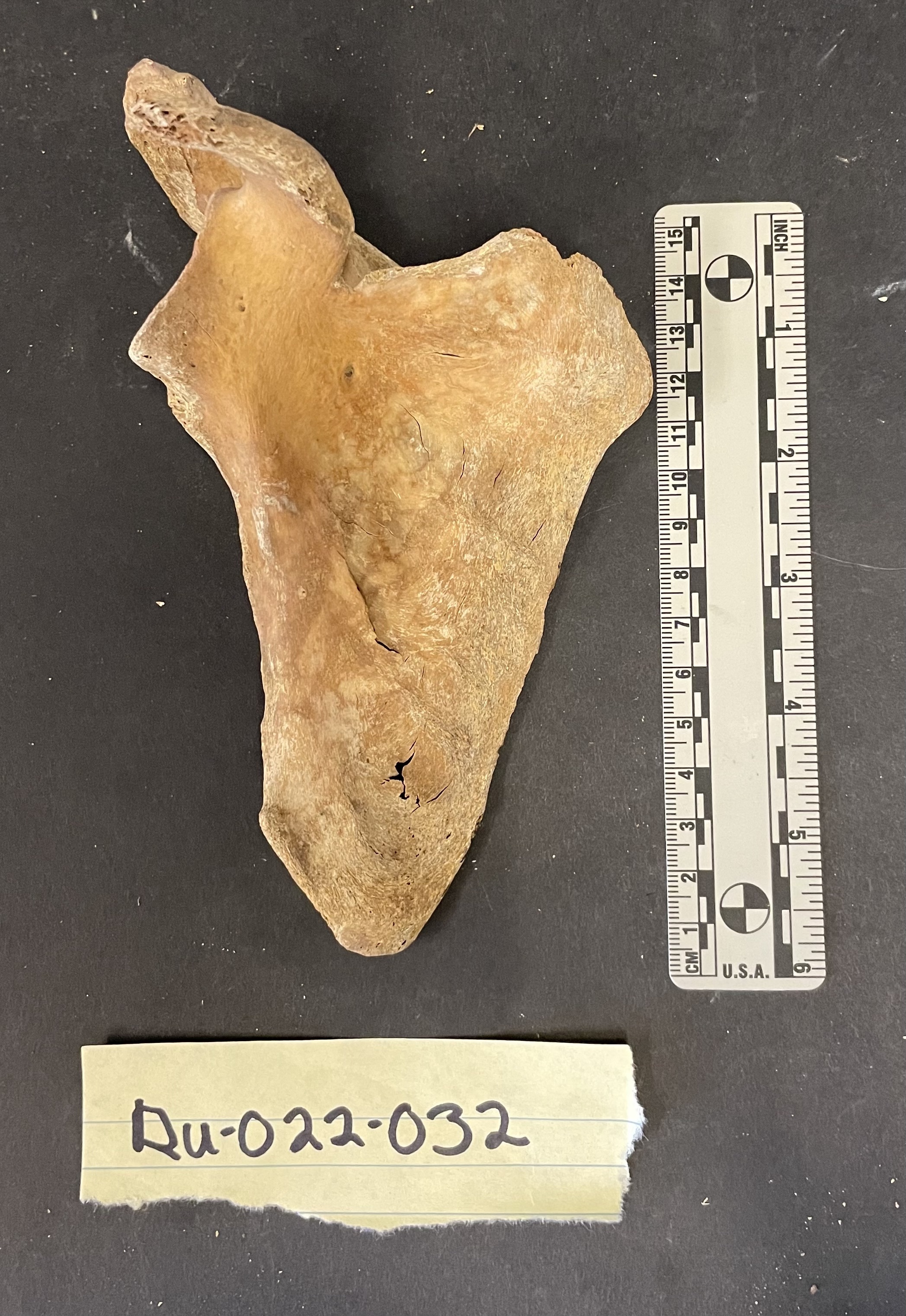 Right scapula 