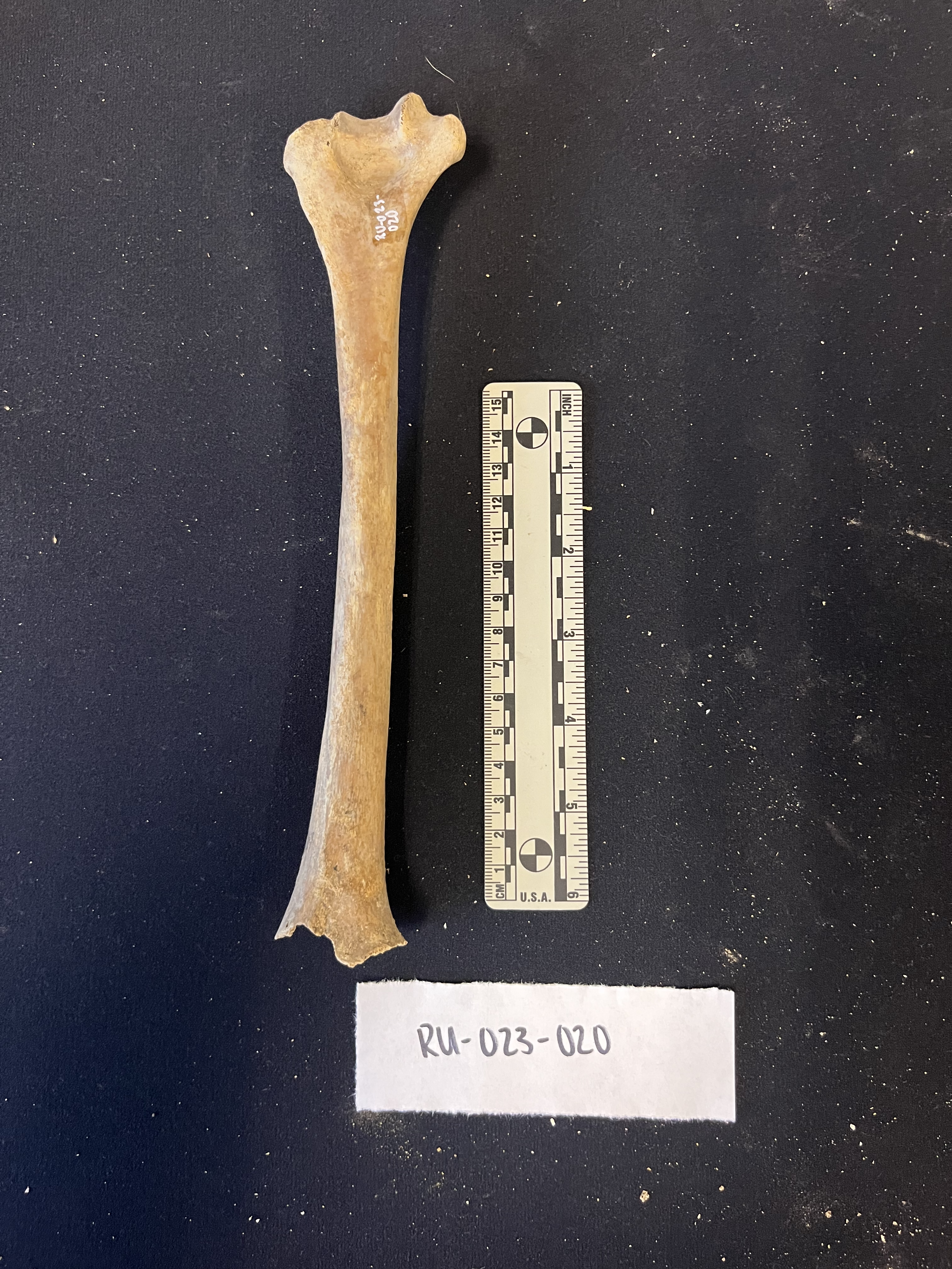 right humerus