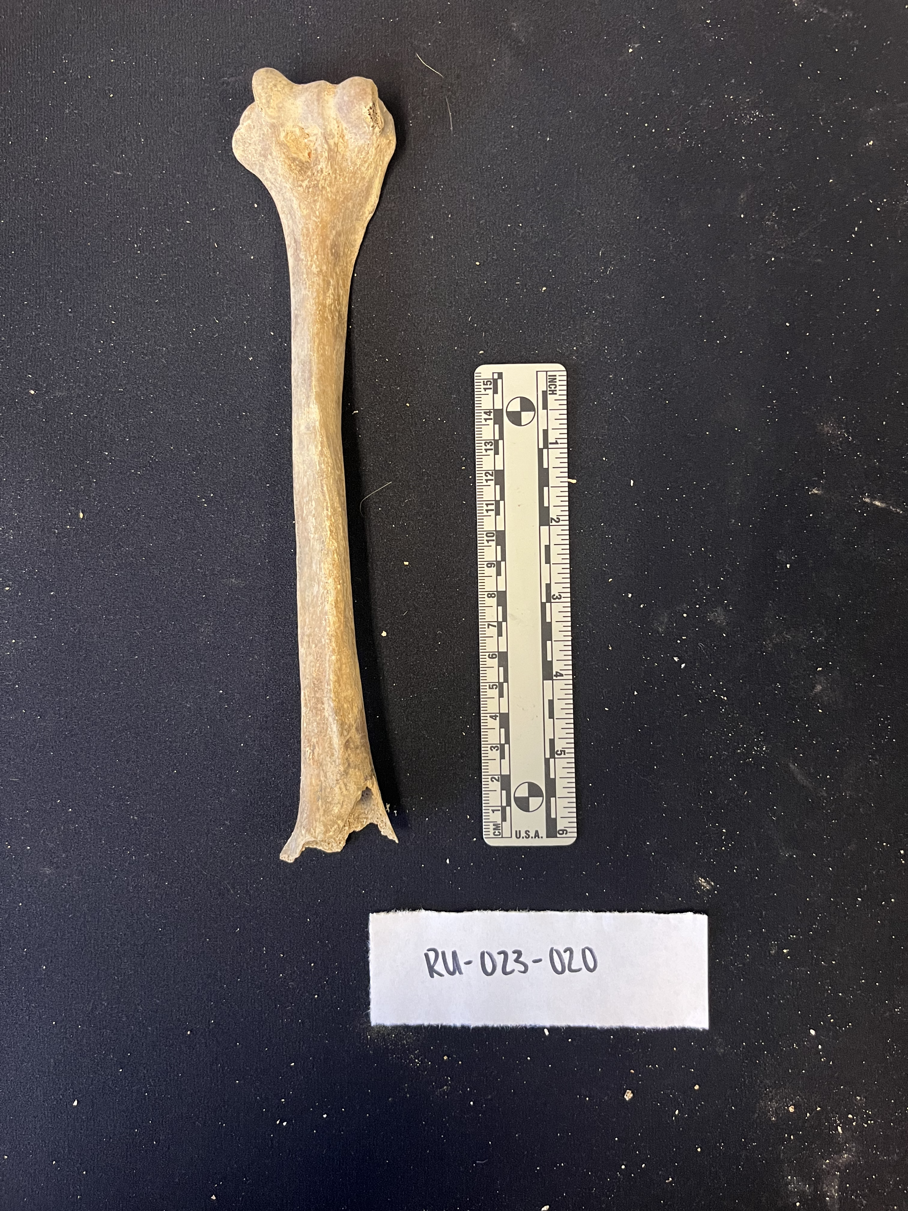 right humerus