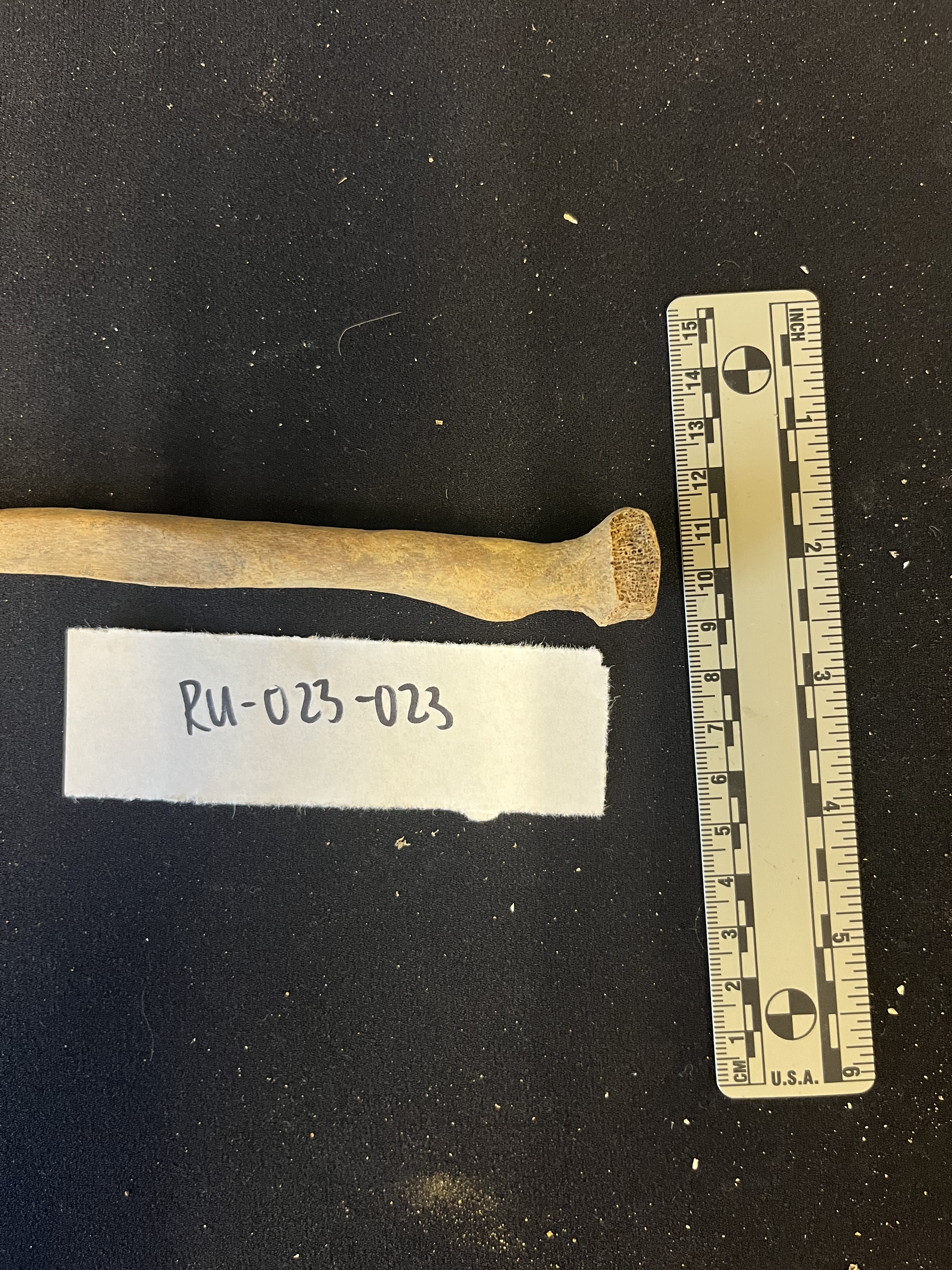 right radius proximal posterior view