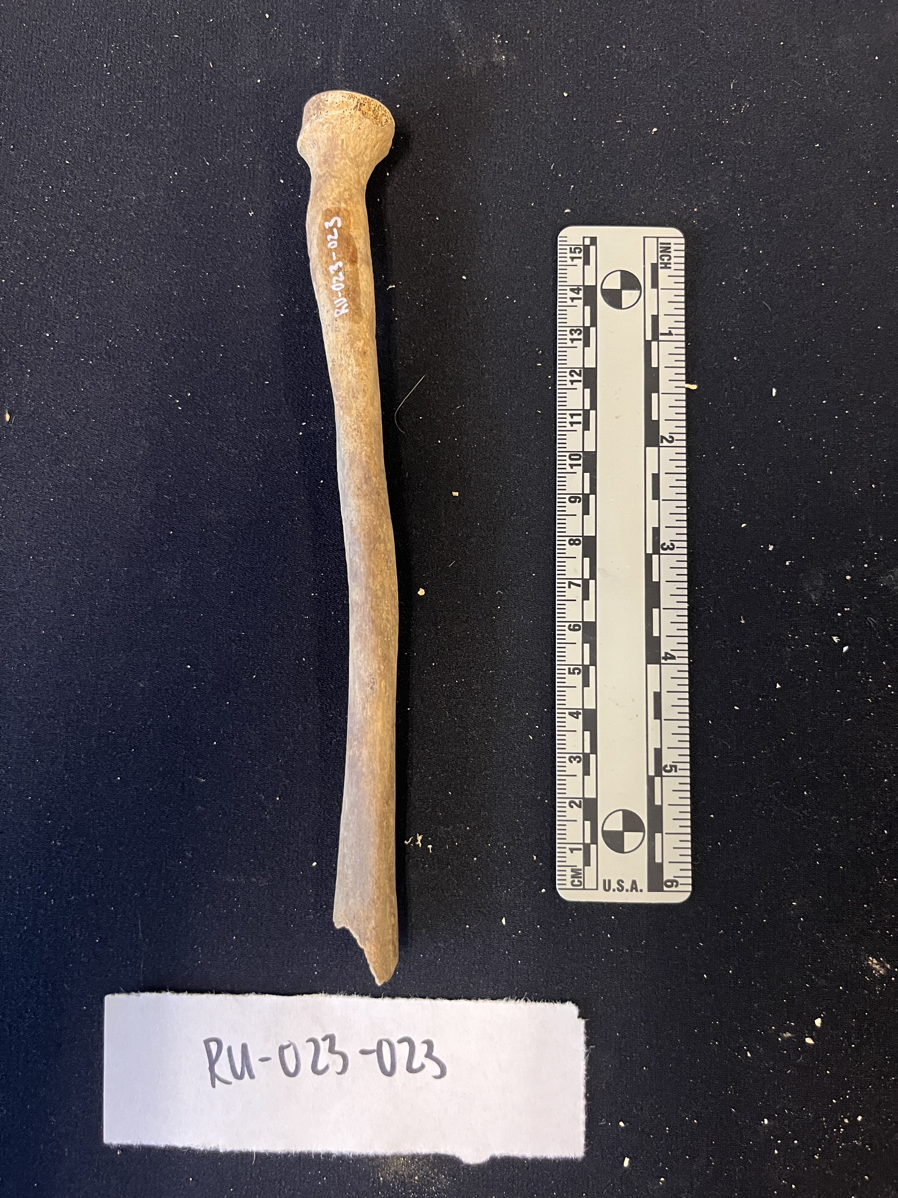 right radius anterior view