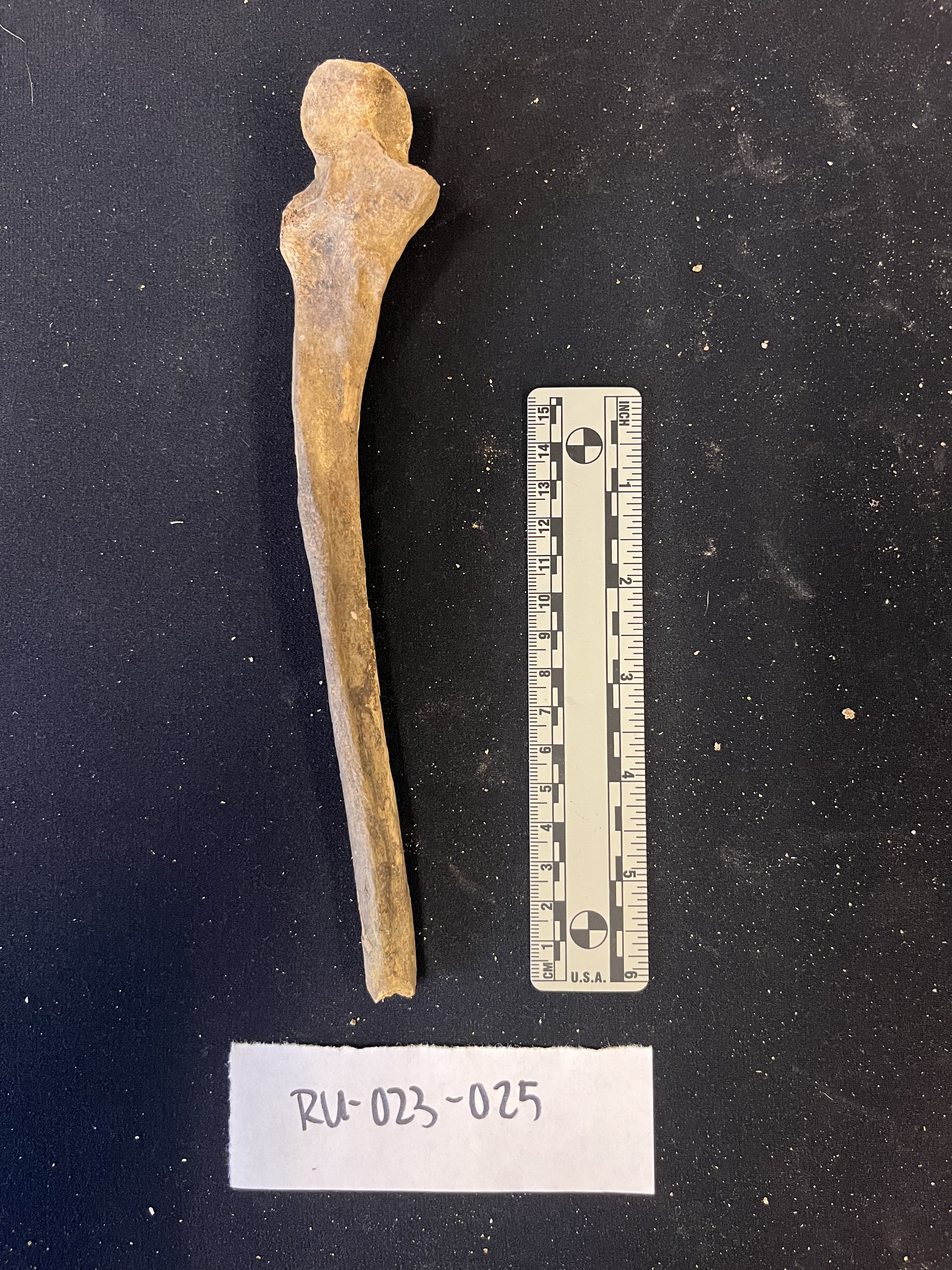 right ulna anterior view