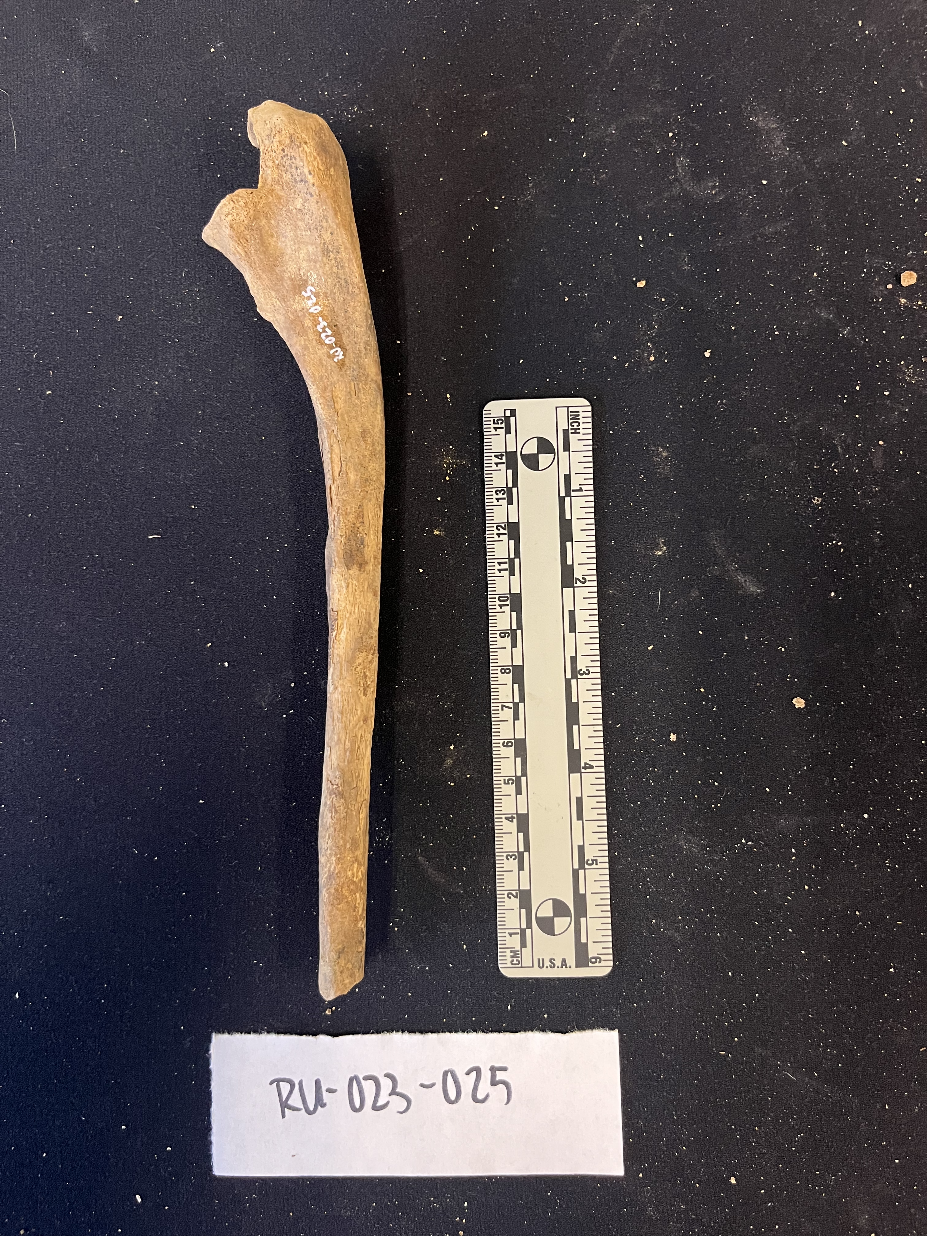right ulna medial view