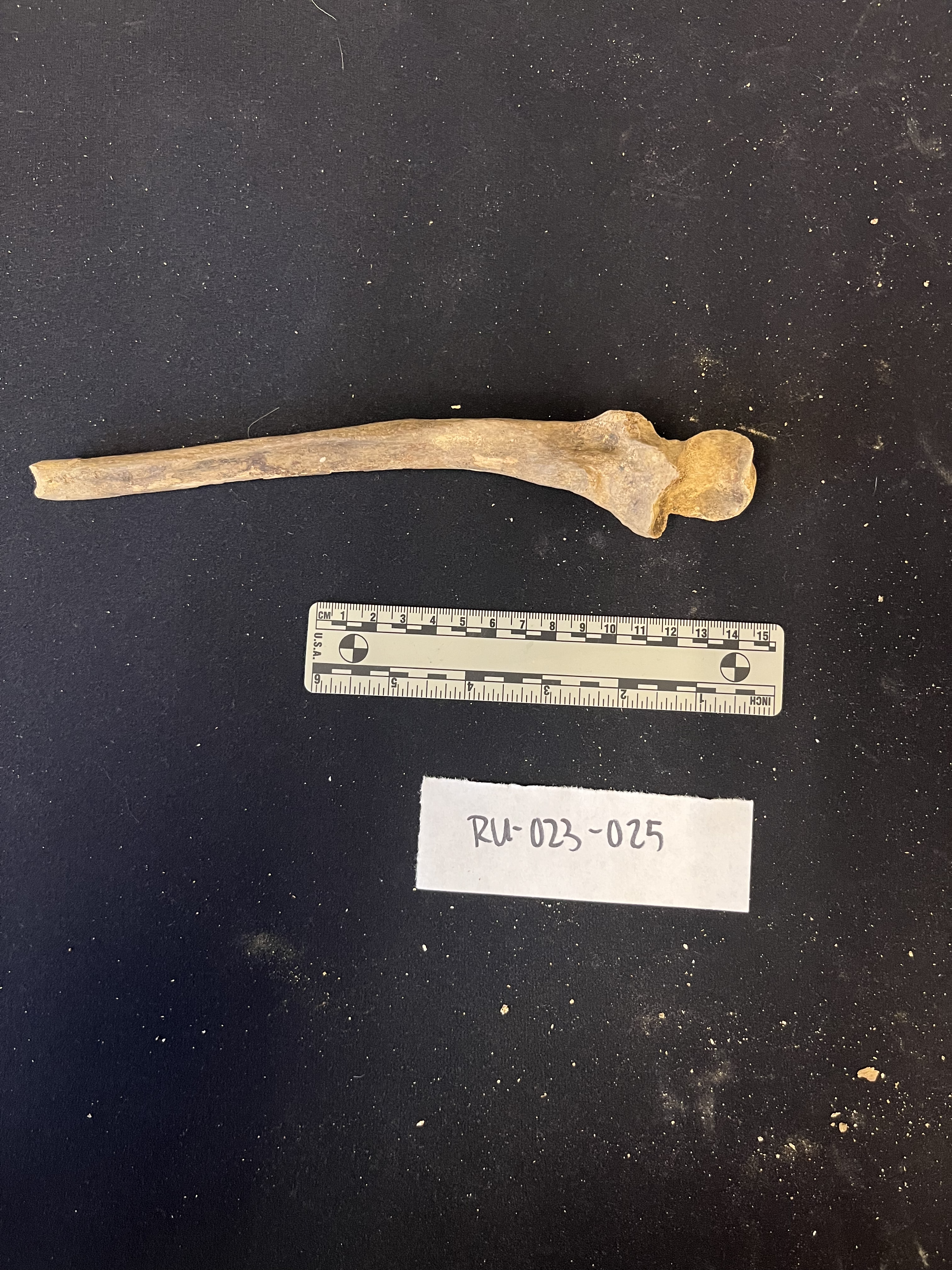 right ulna anterior view