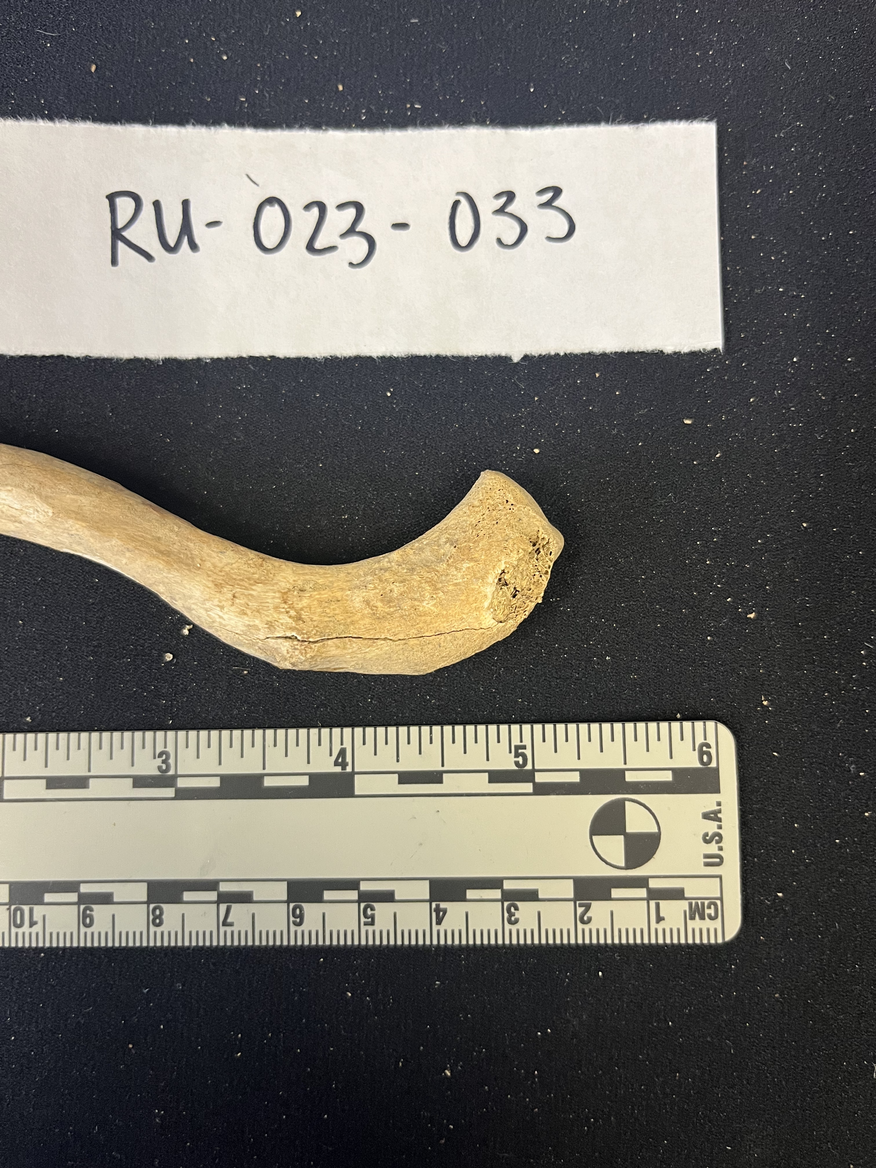 left clavicle inferior acromial end 