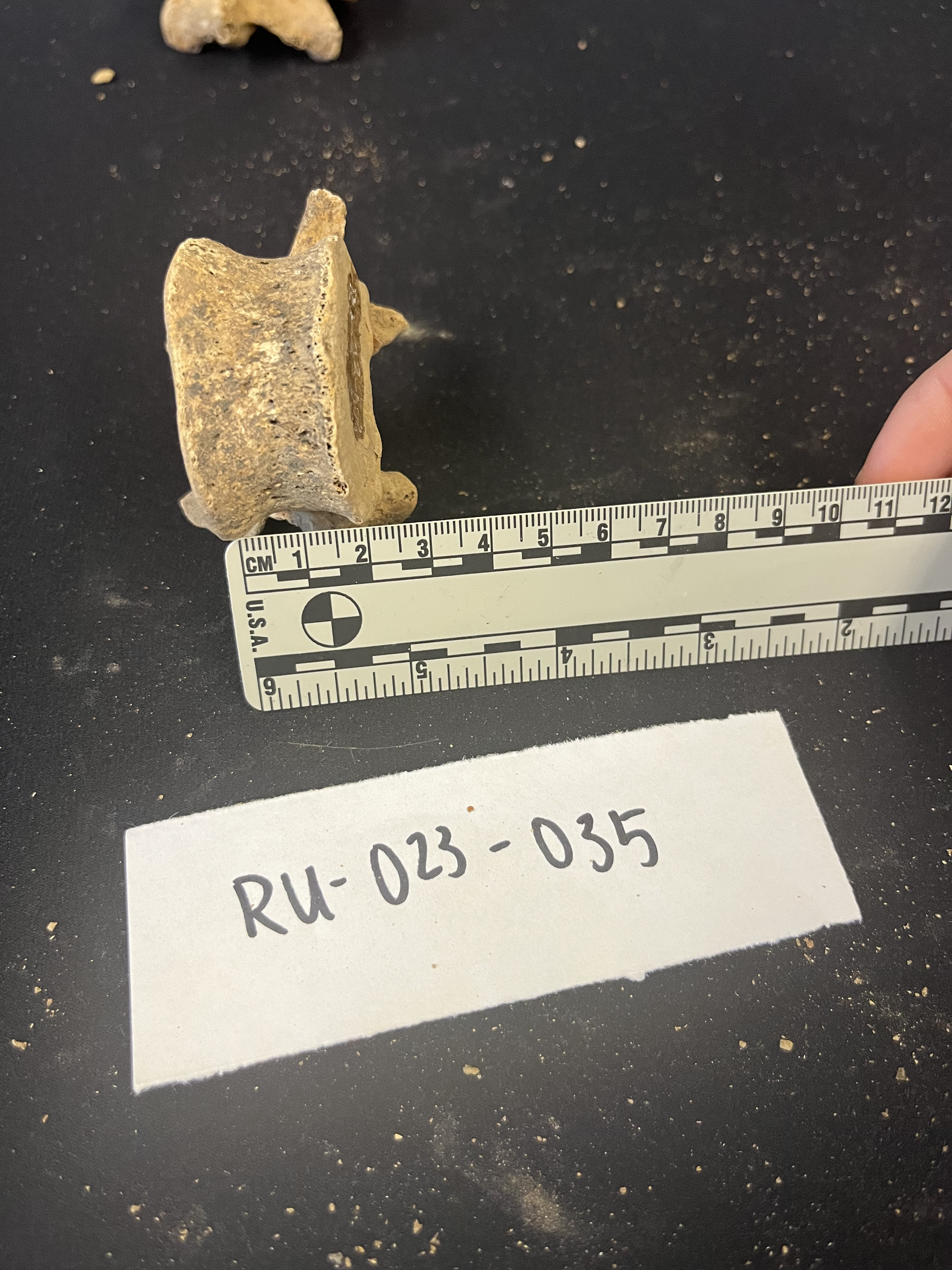 lumbar vertebrae