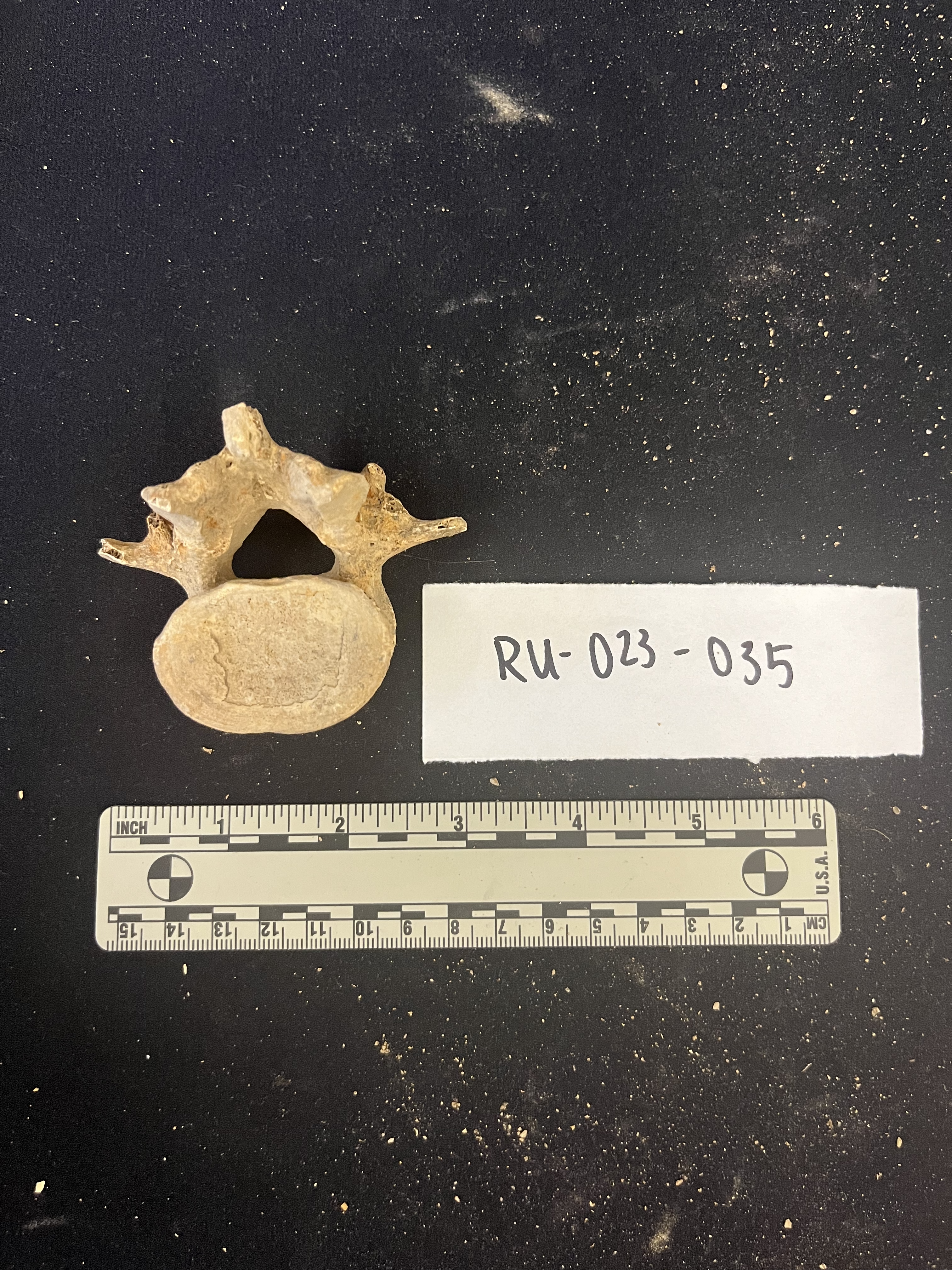 lumbar vertebrae