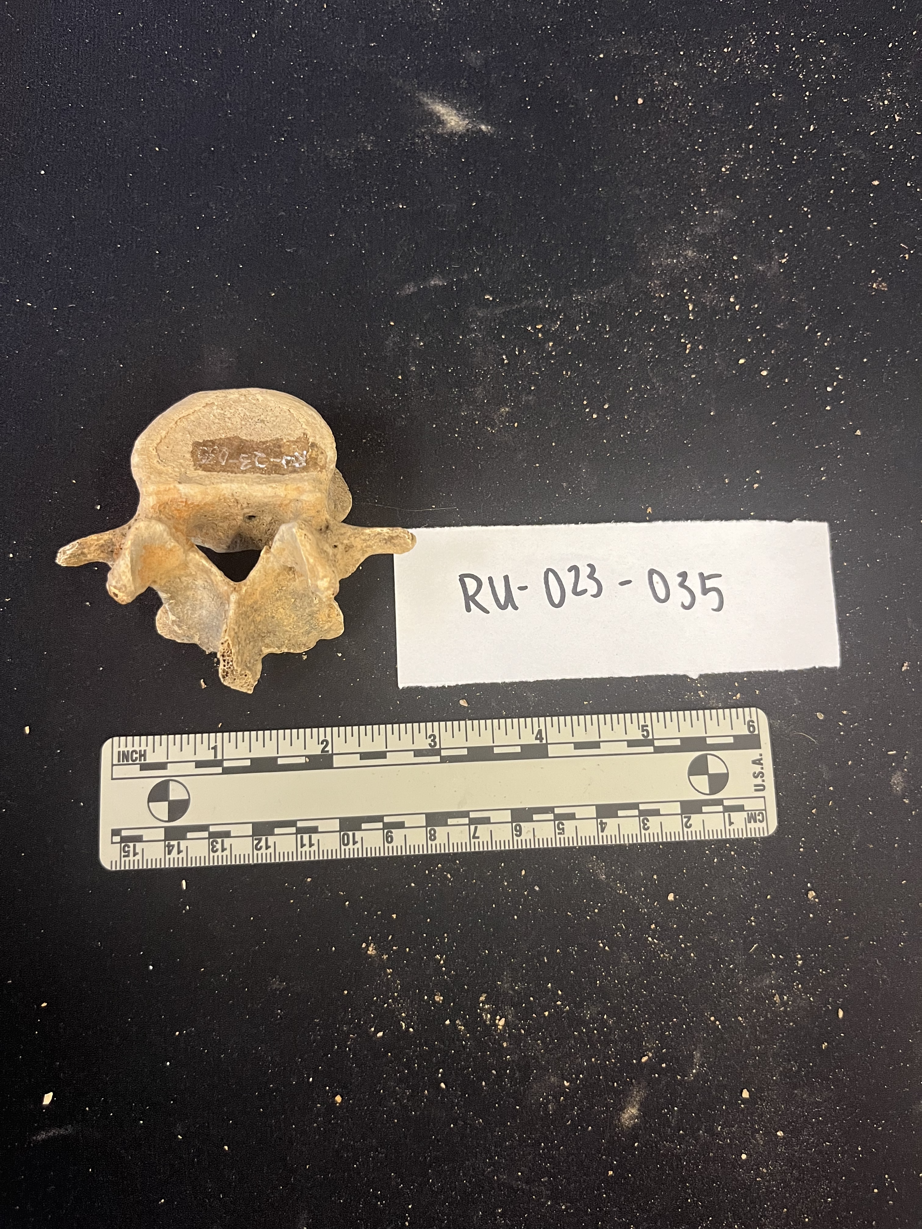 lumbar vertebrae