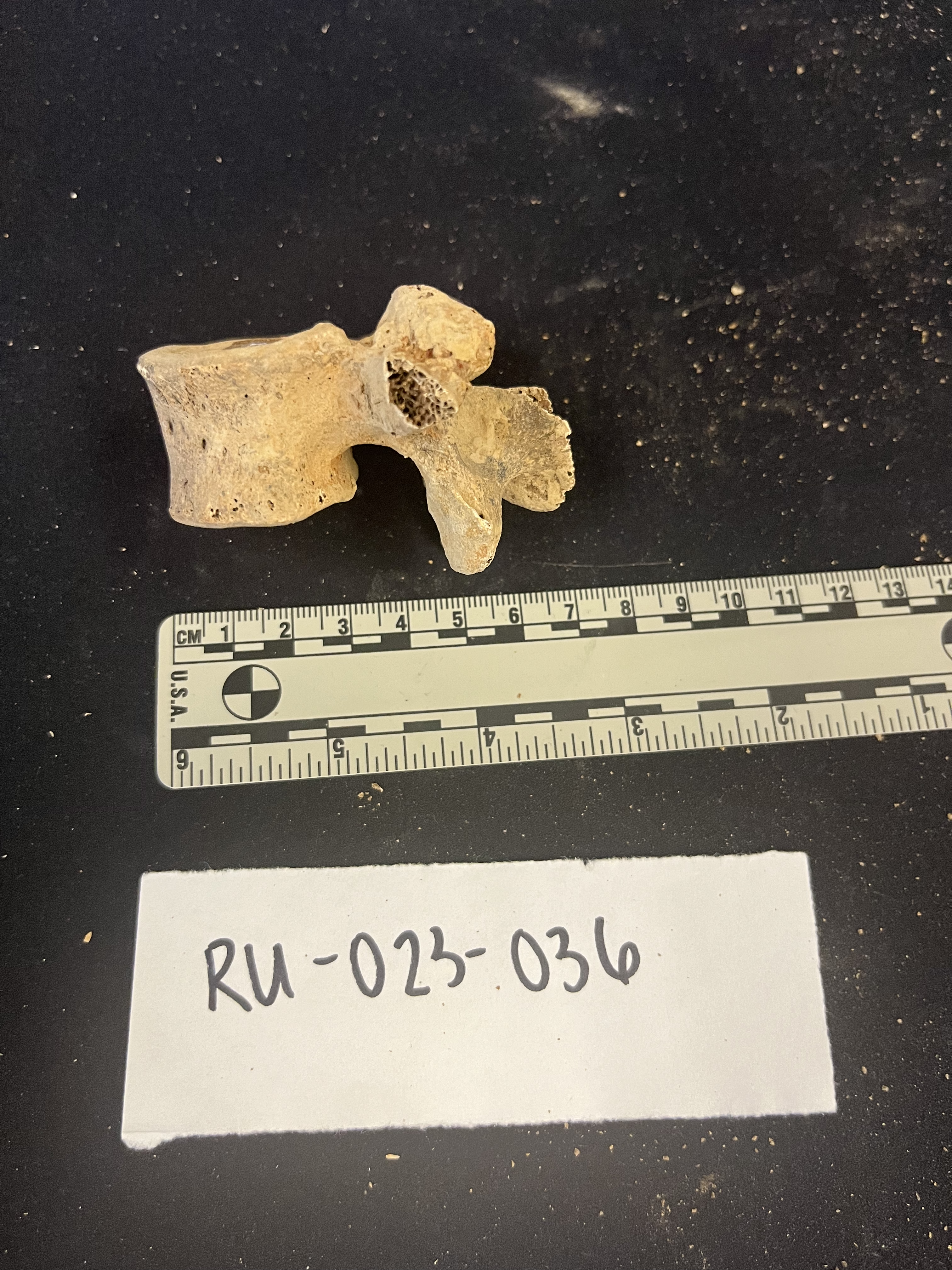 lumbar vertebrae