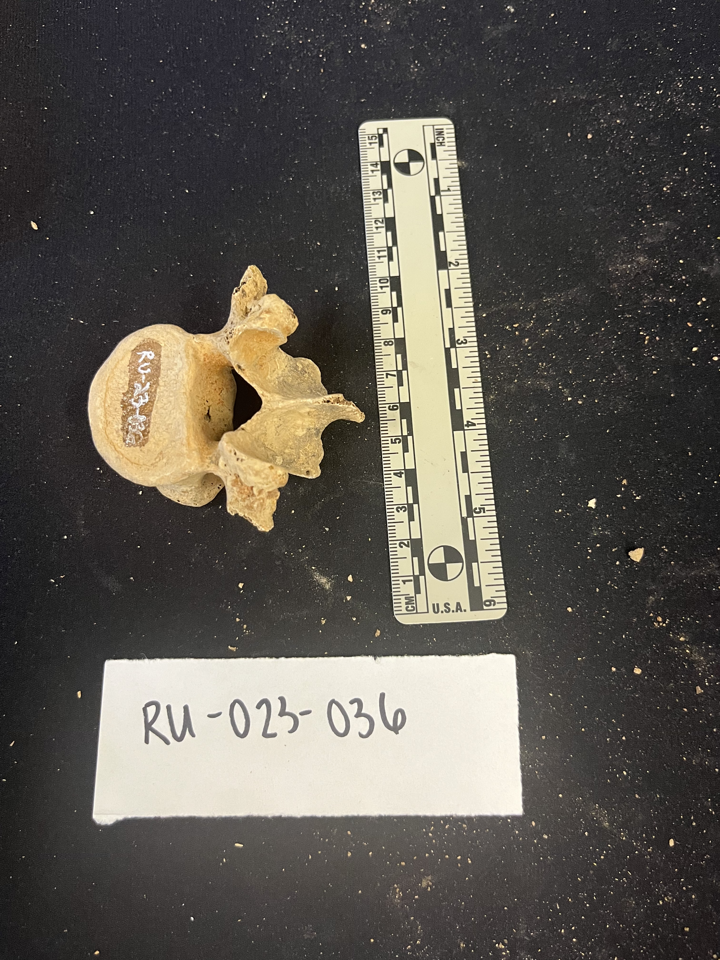 lumbar vertebrae