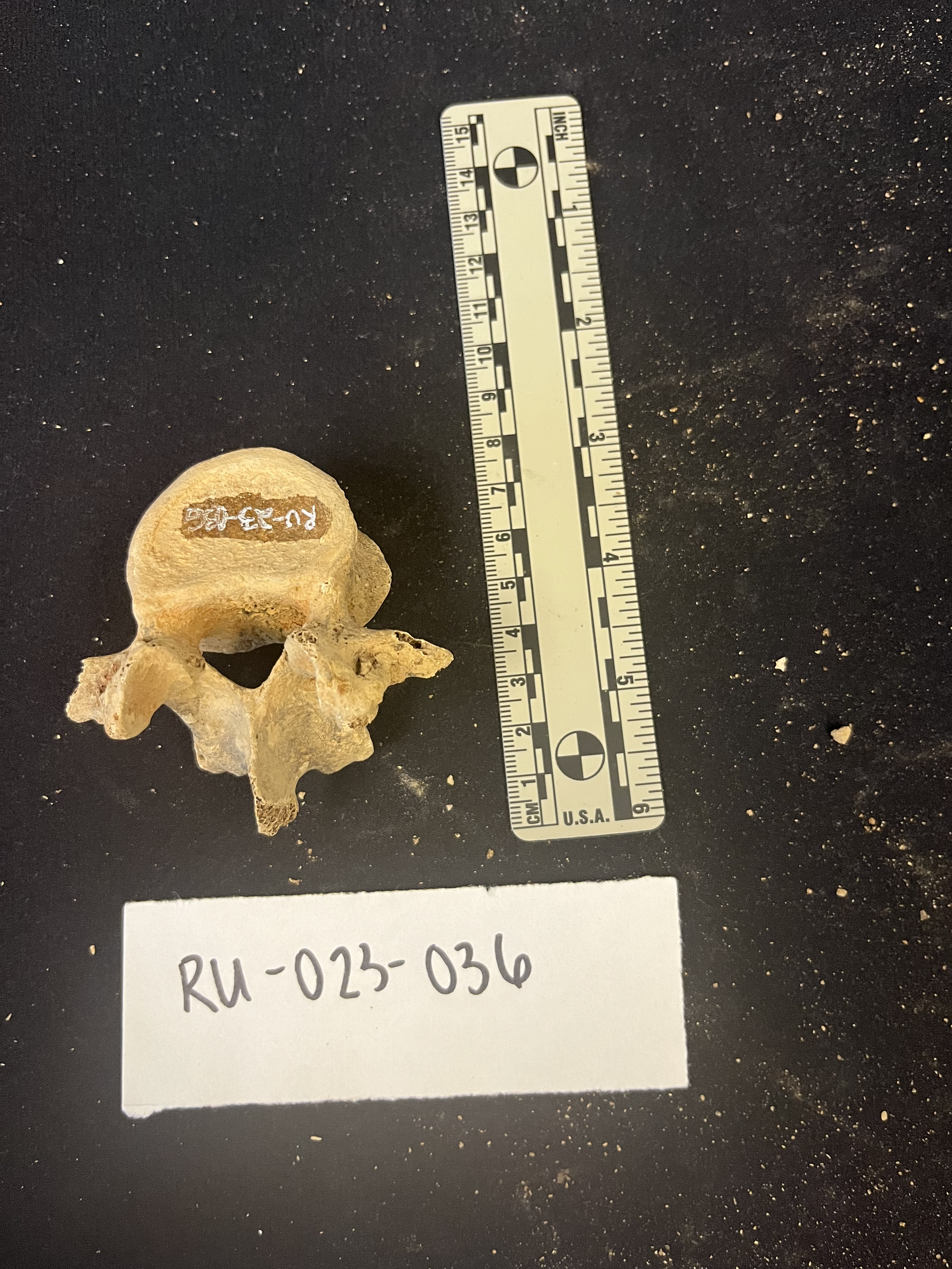 lumbar vertebrae