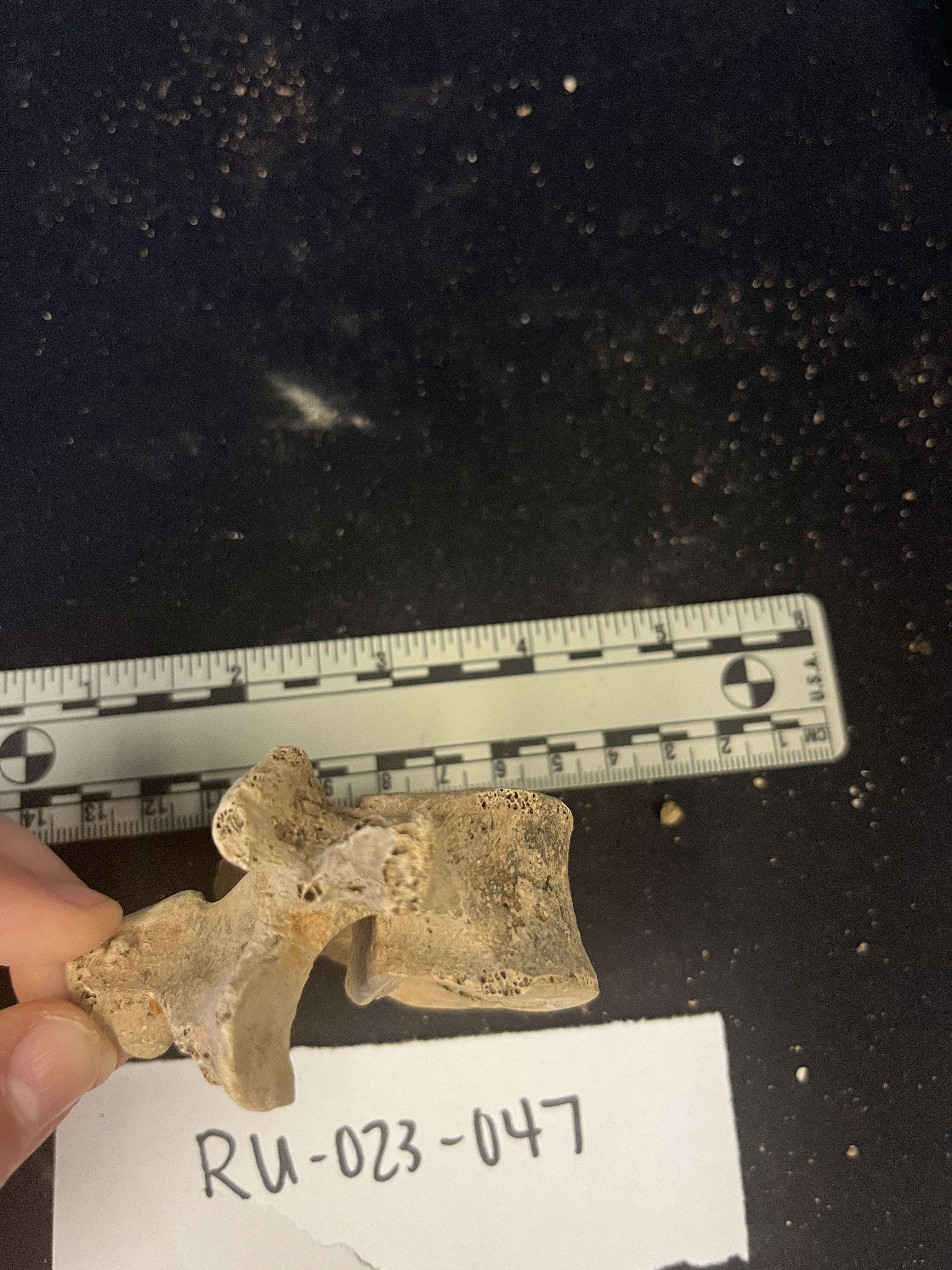 lumbar vertebrae