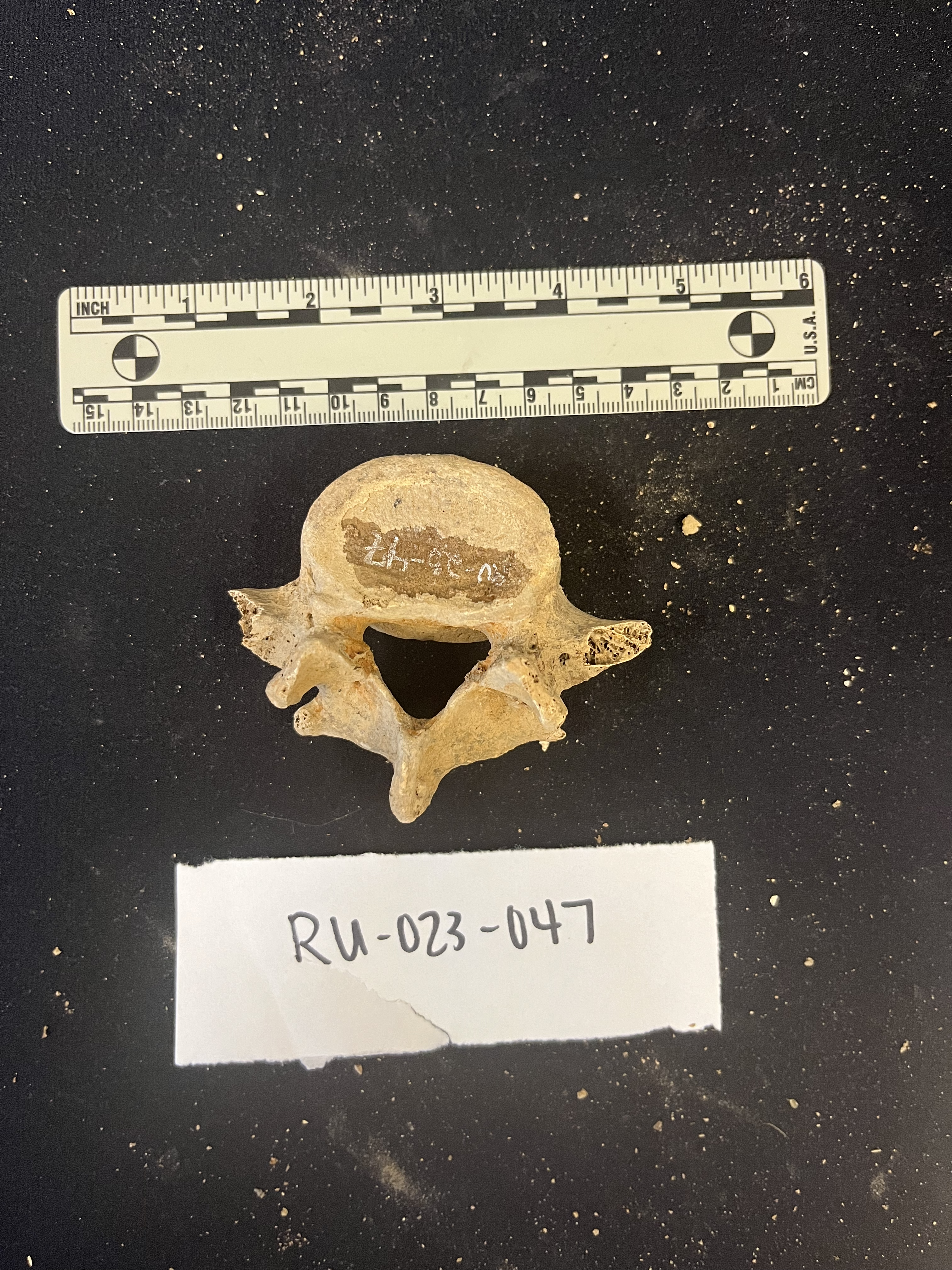 lumbar vertebrae