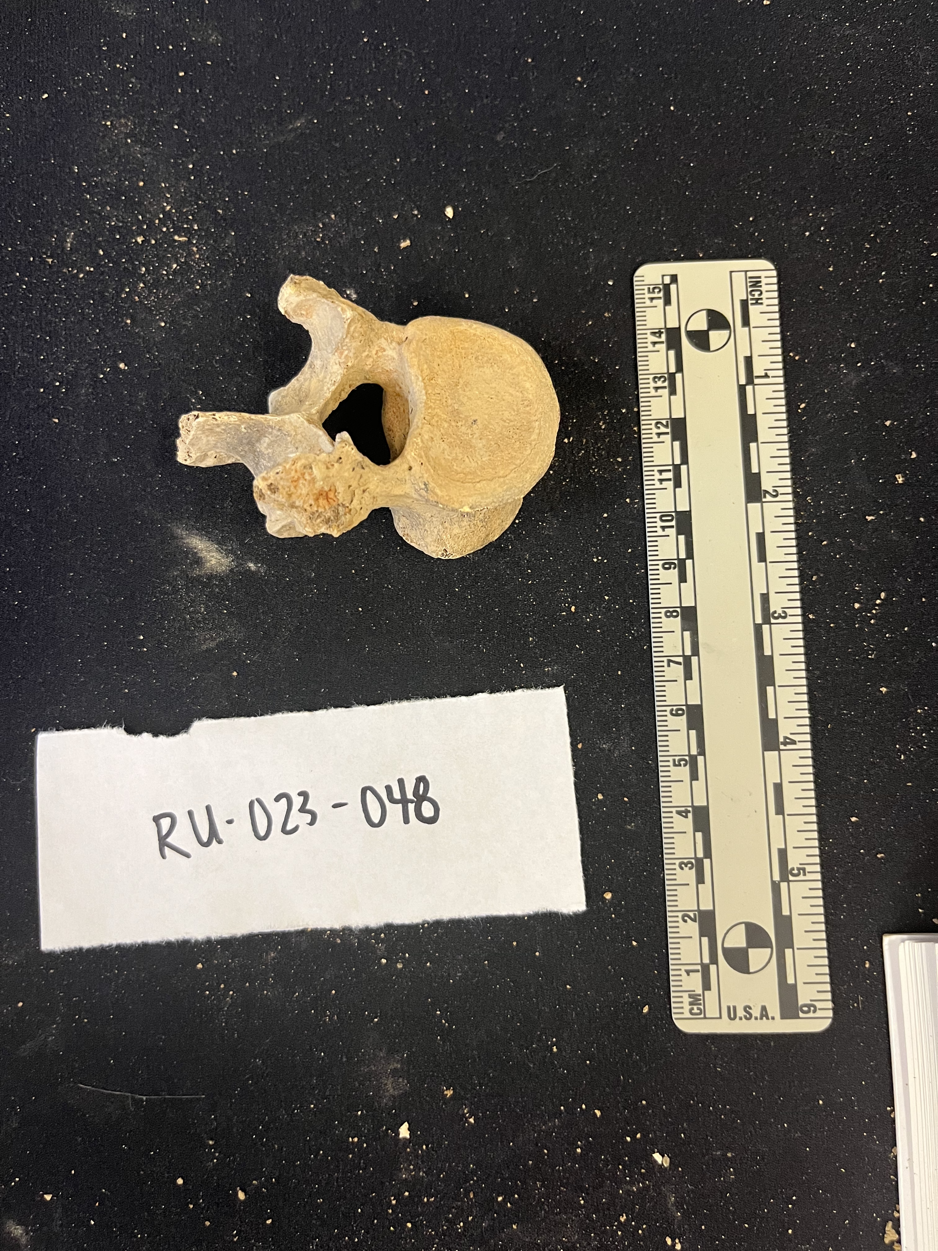thoracic vertebrae