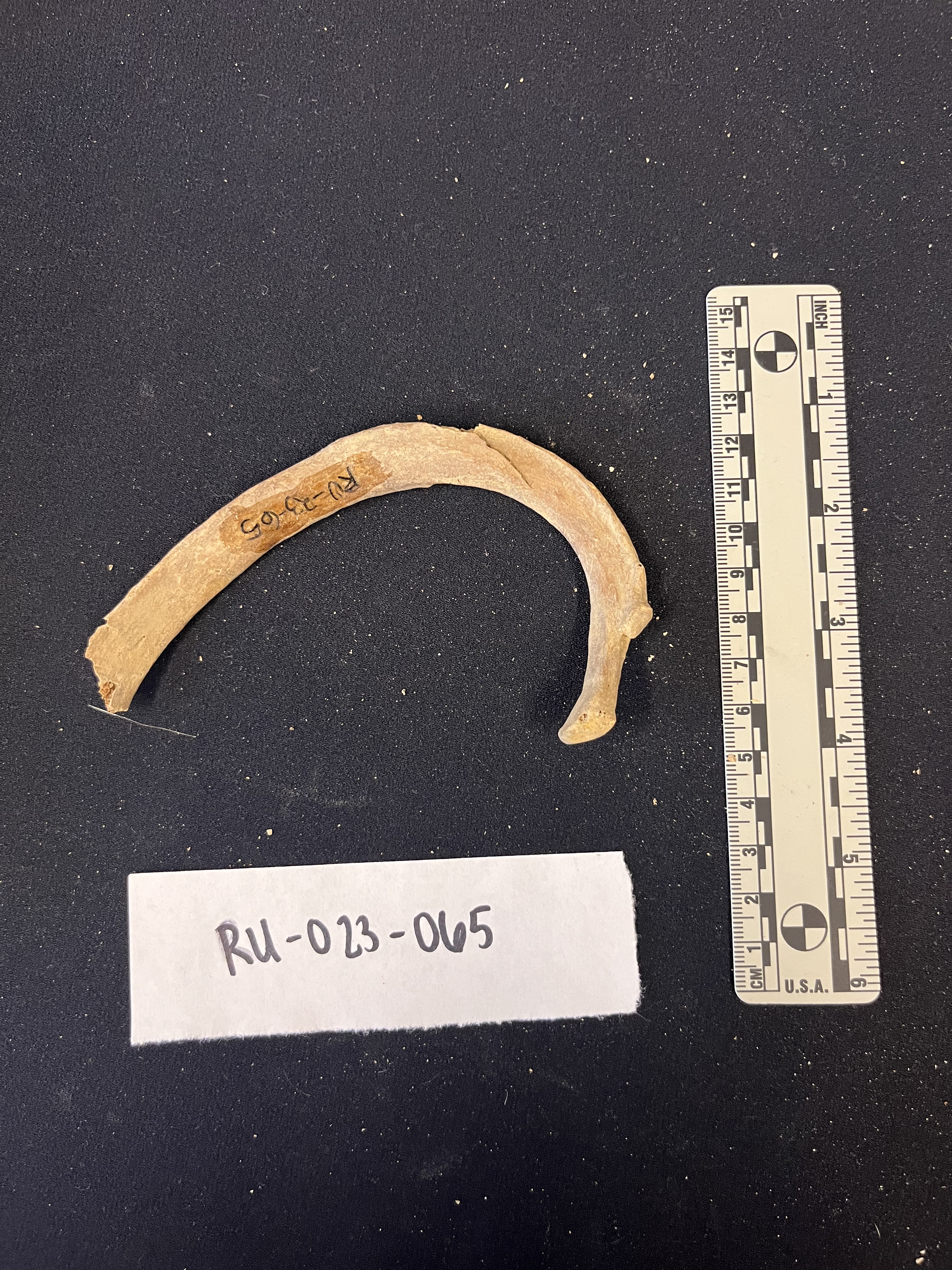 1st left rib inferior view