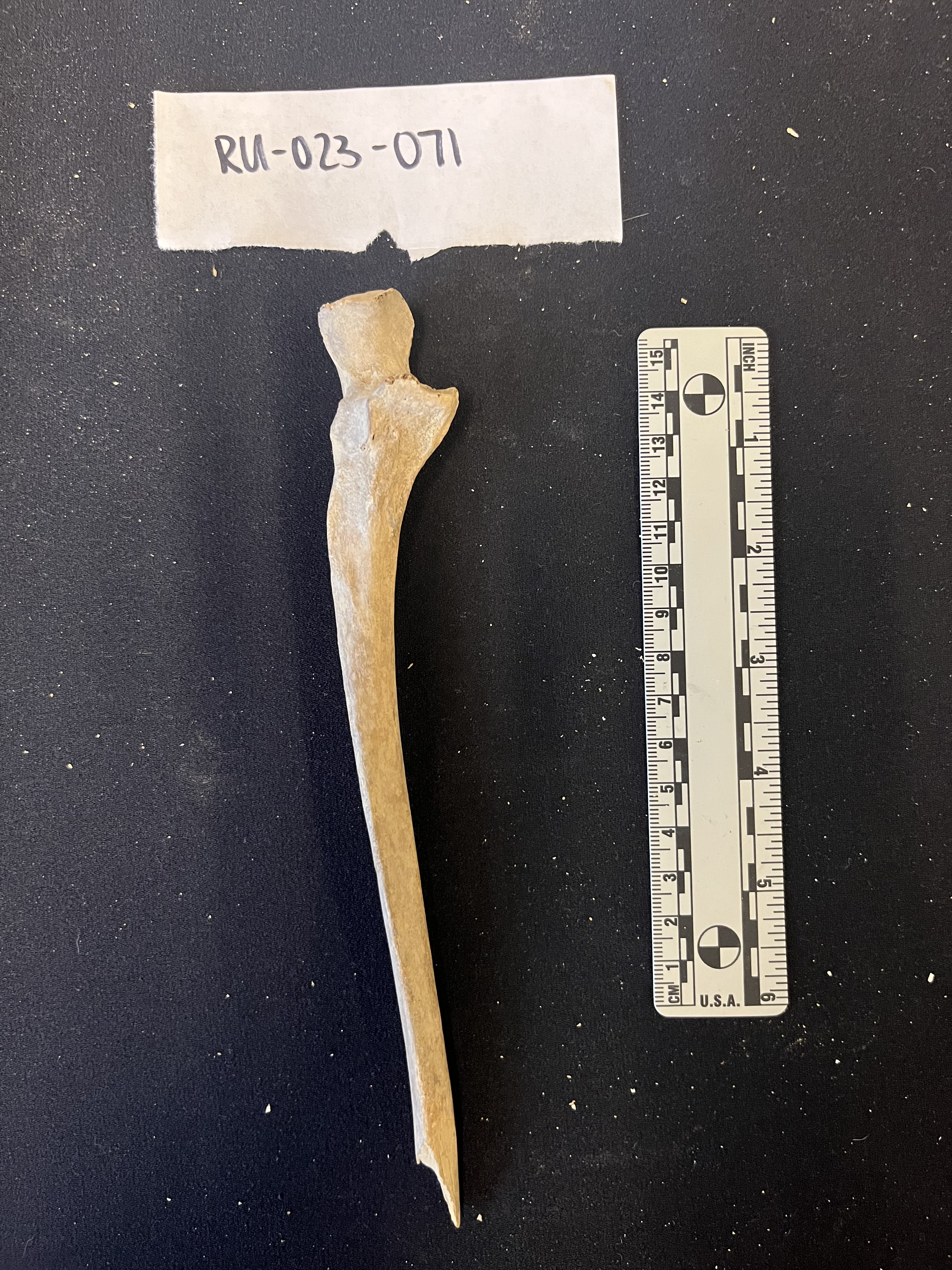 right ulna anterior view