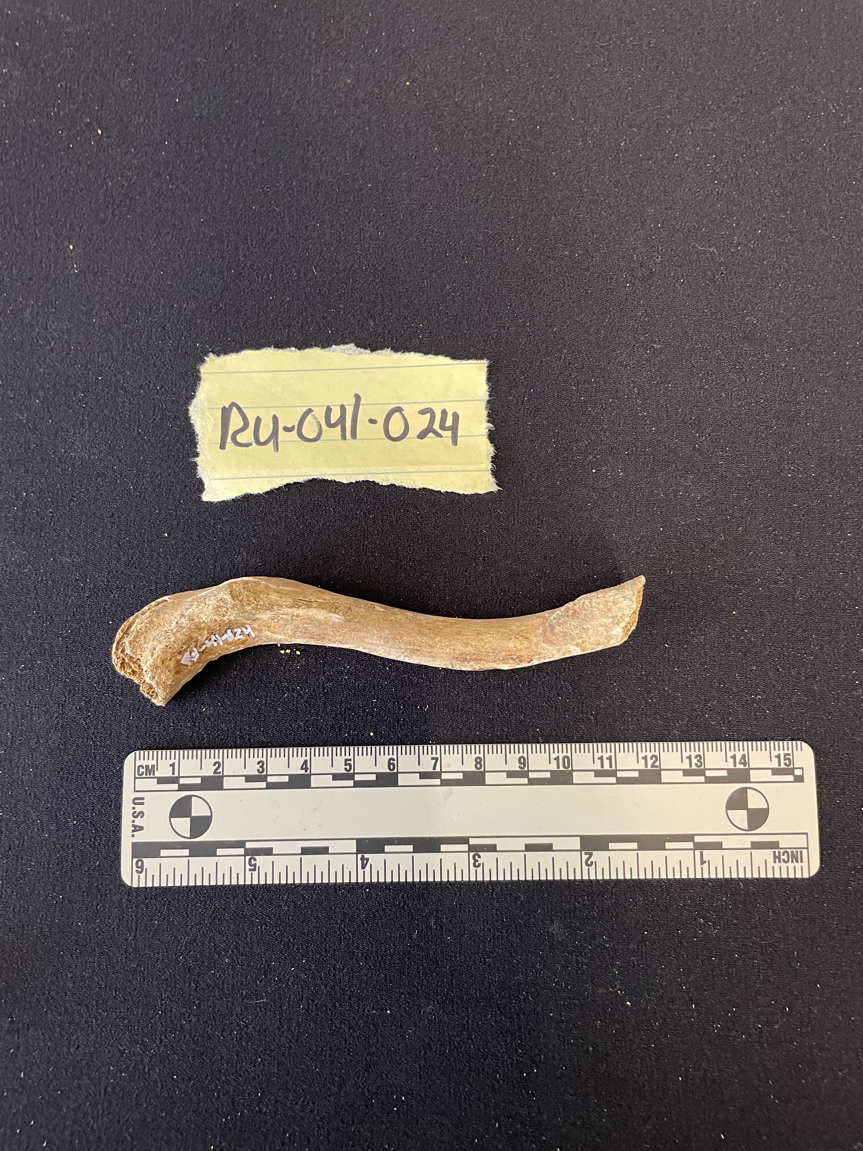 Left clavicle 