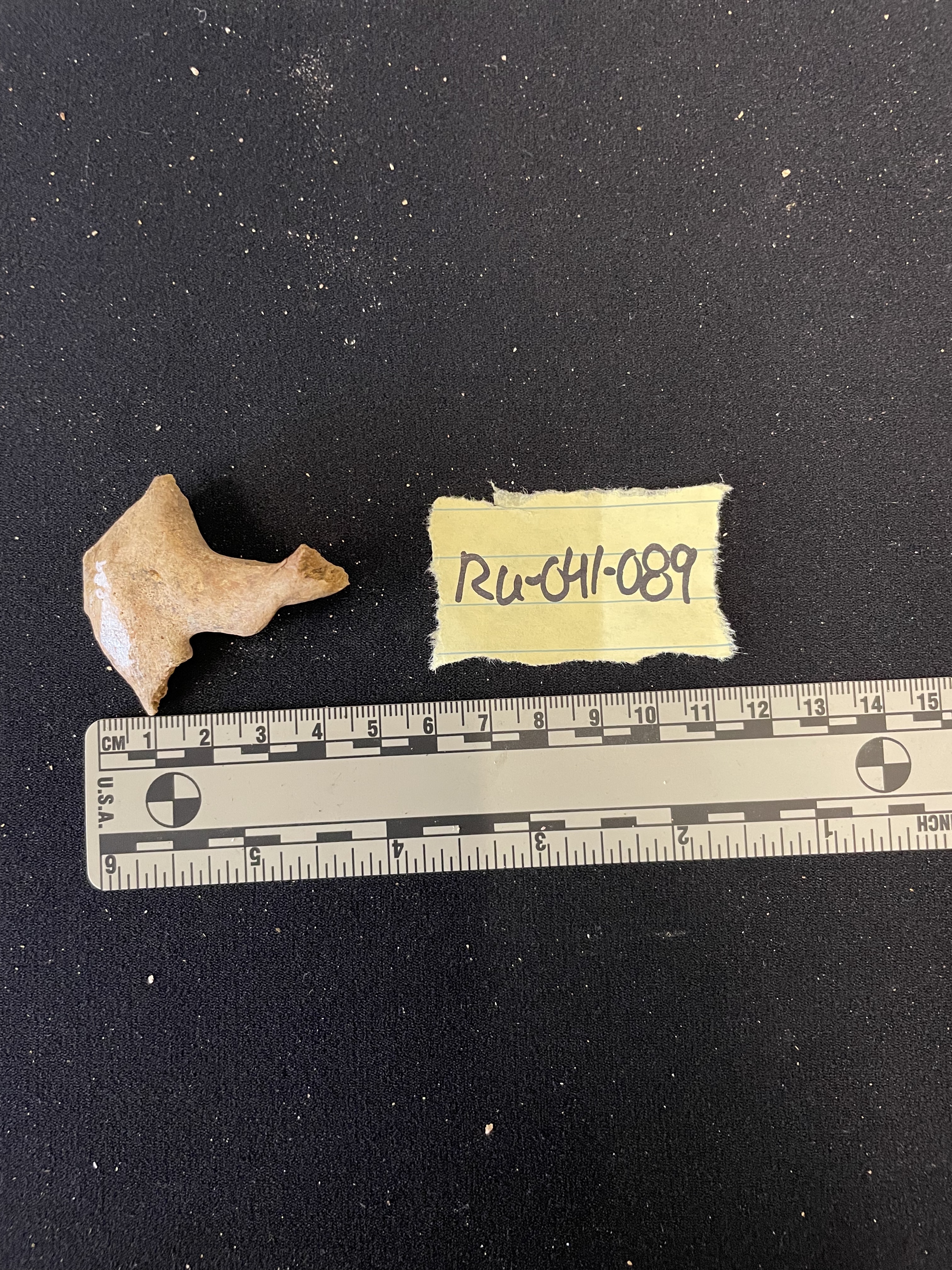 Partial zygomatic 